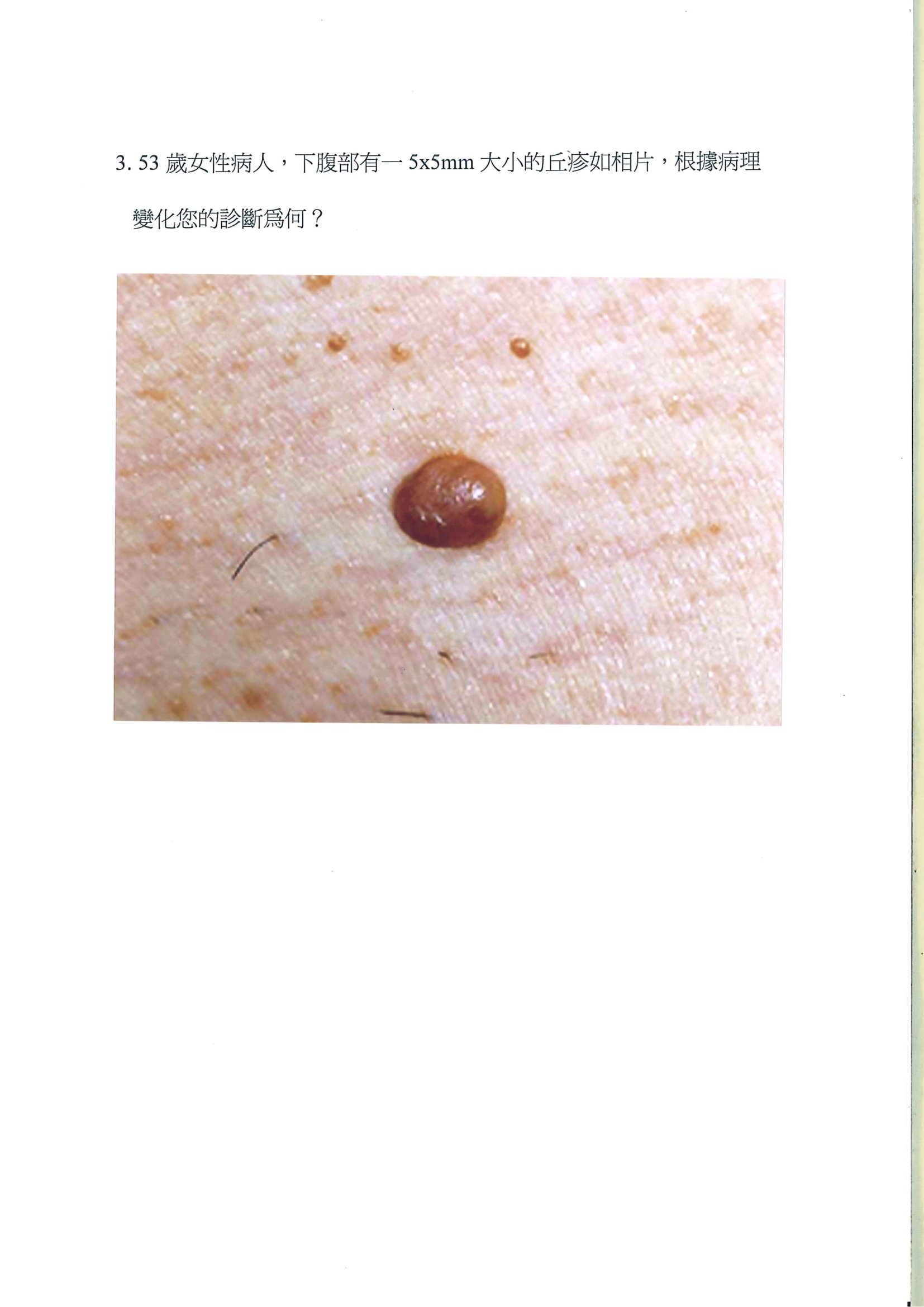 第3題 (p.3)