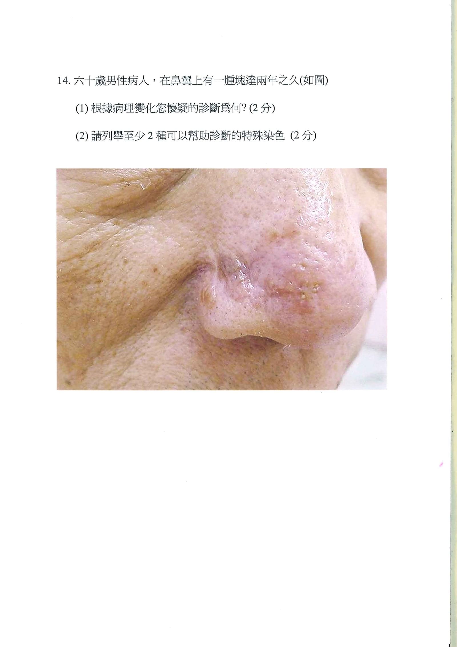 第14題 (p.14)