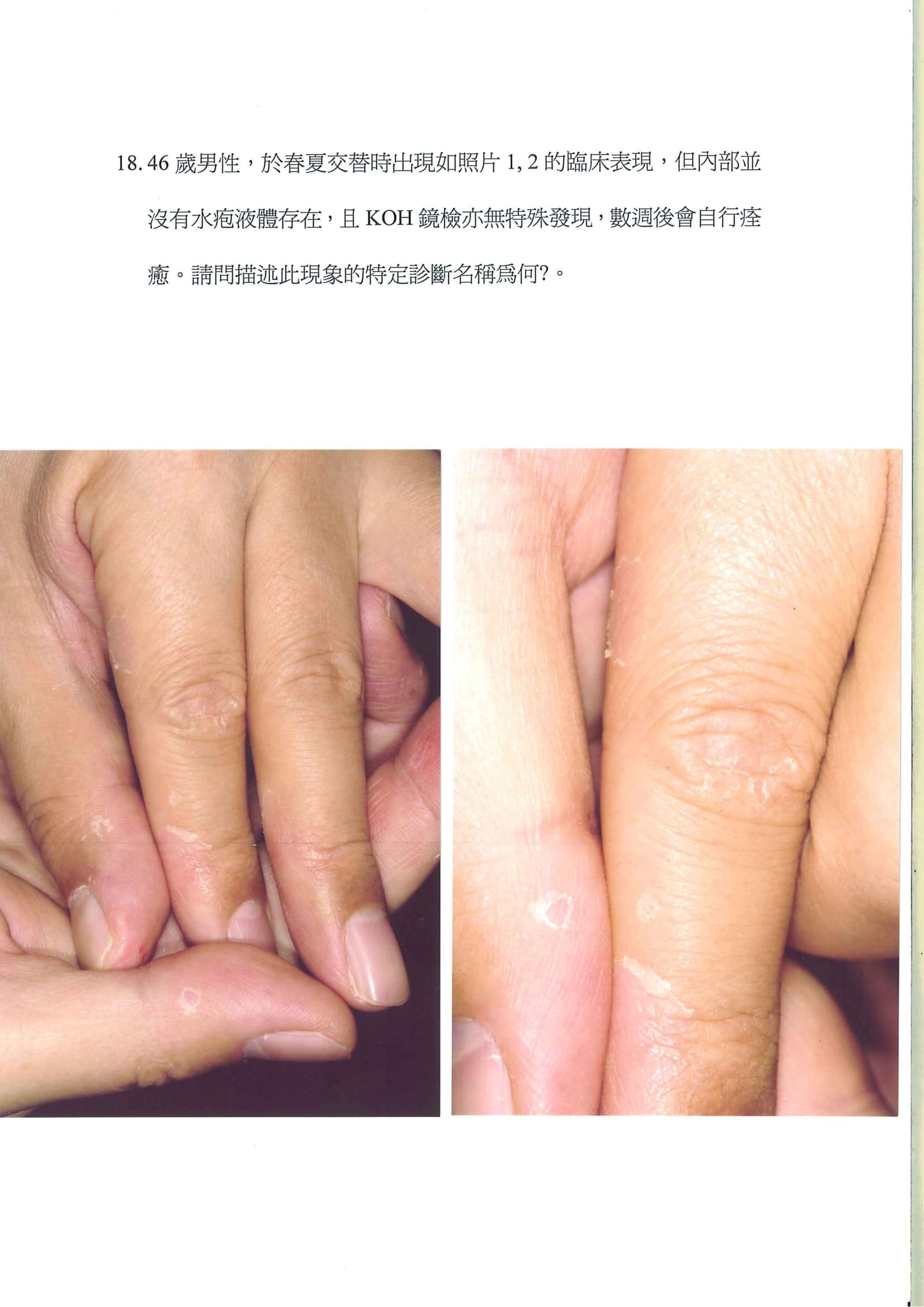 第18題 (p.20)