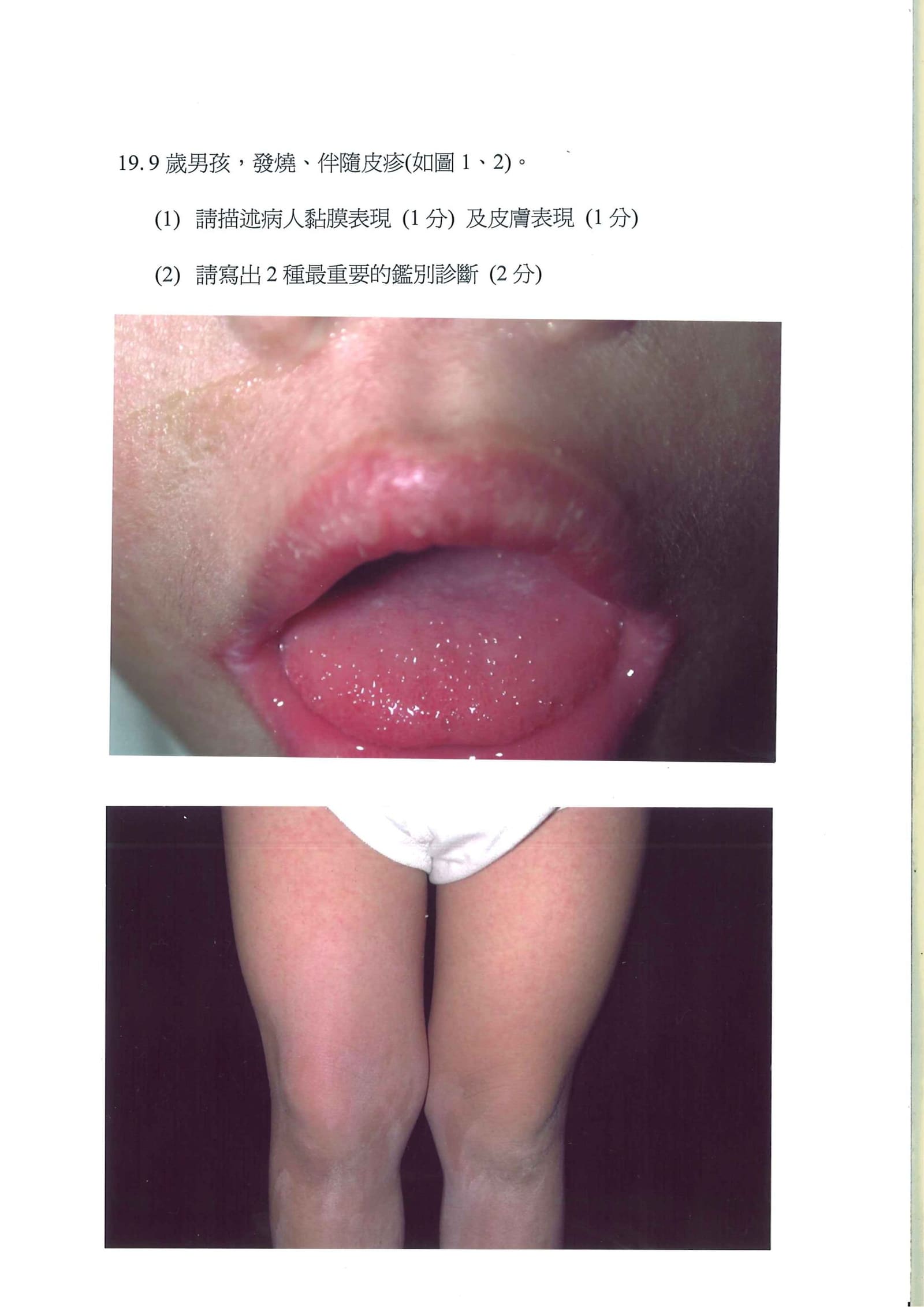 第19題 (p.21)