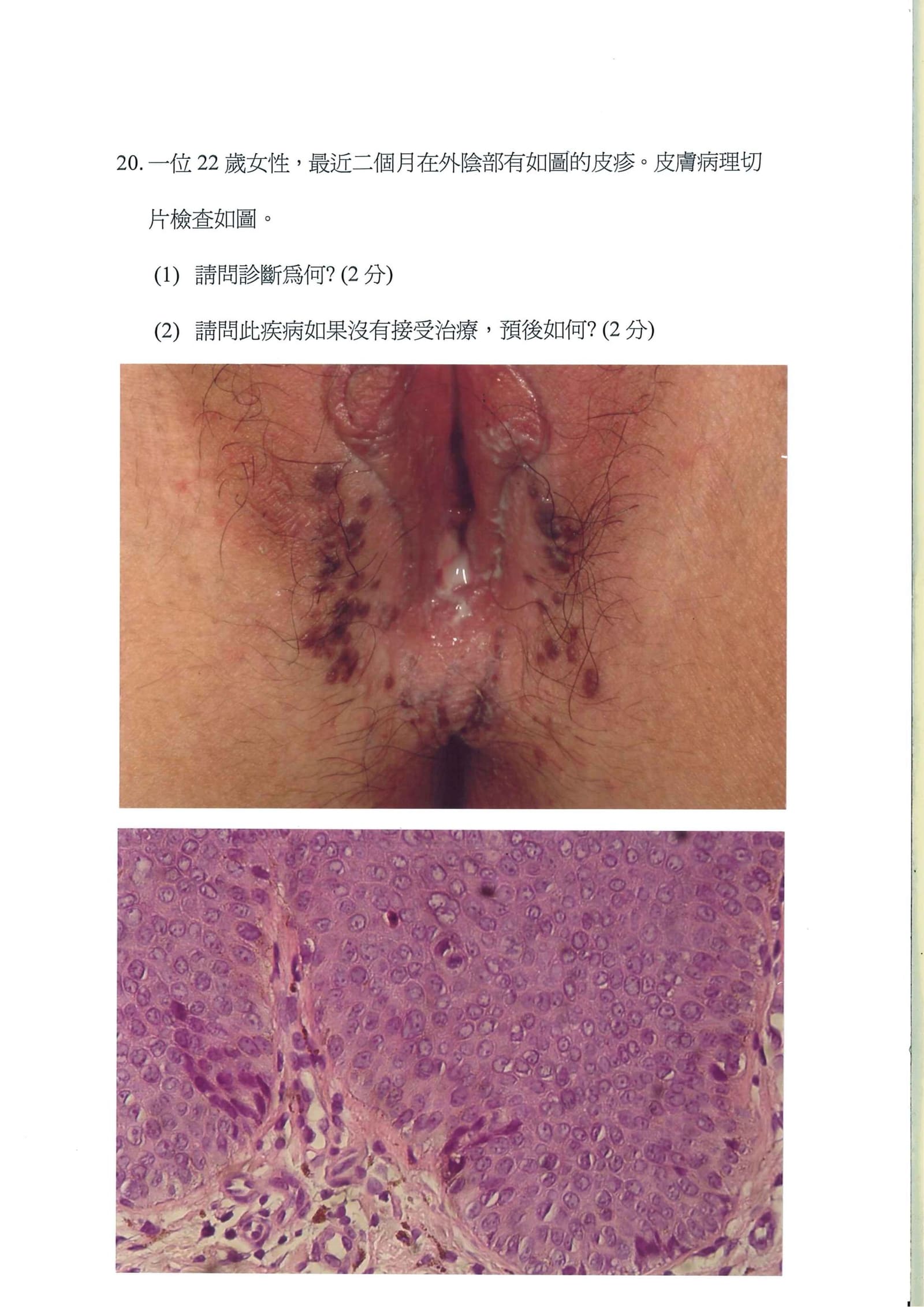 第20題 (p.22)