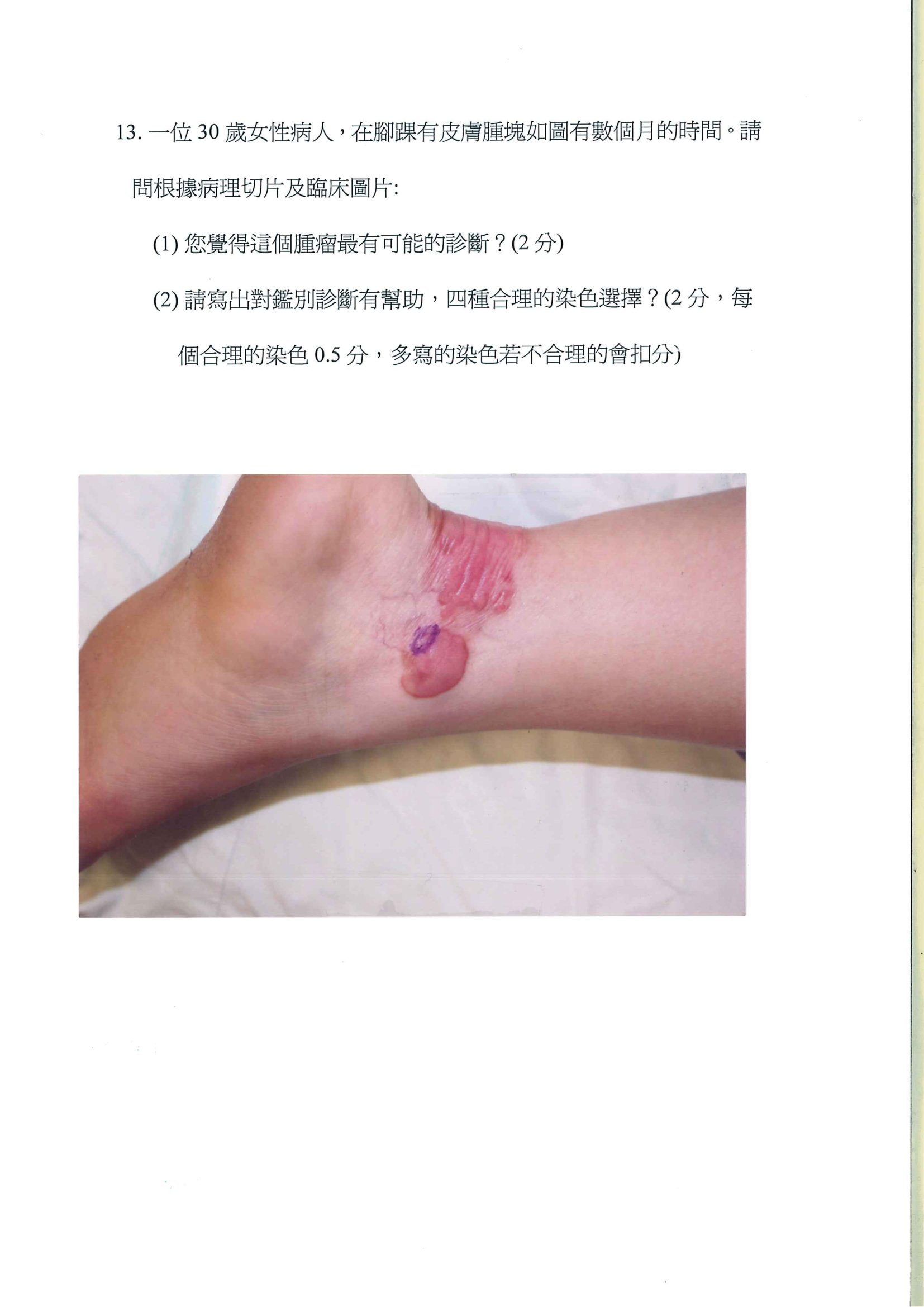 第13題 (p.18)