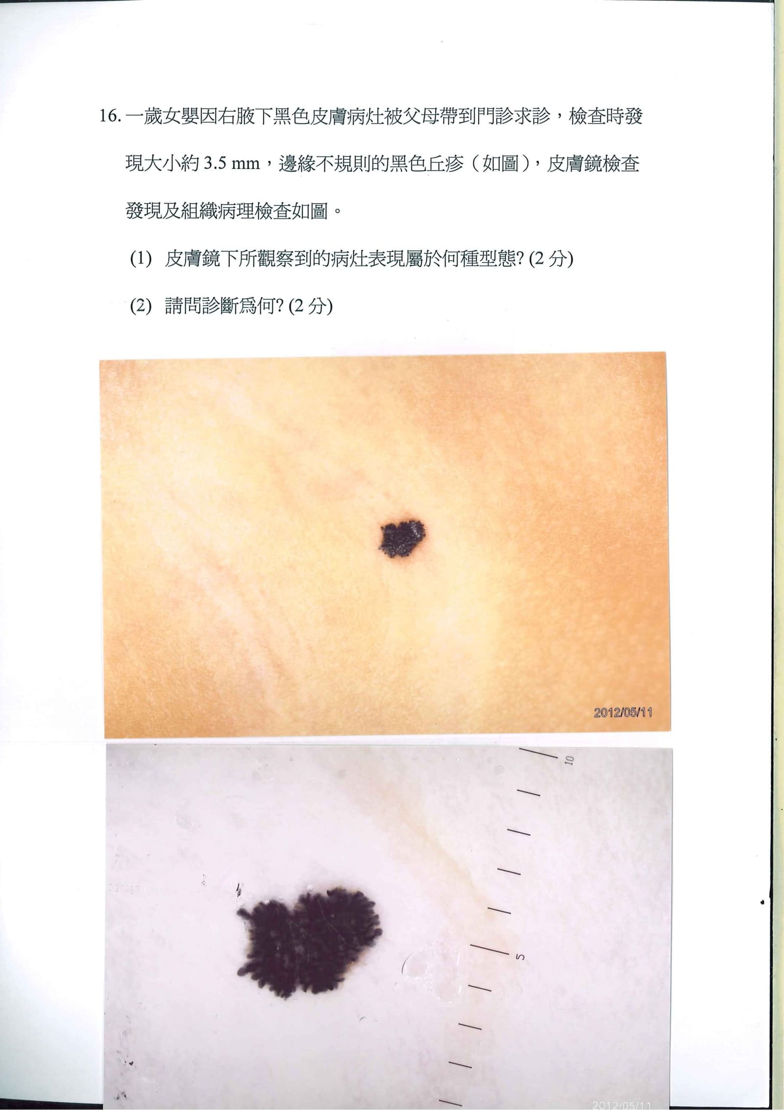 第16題 (p.21)