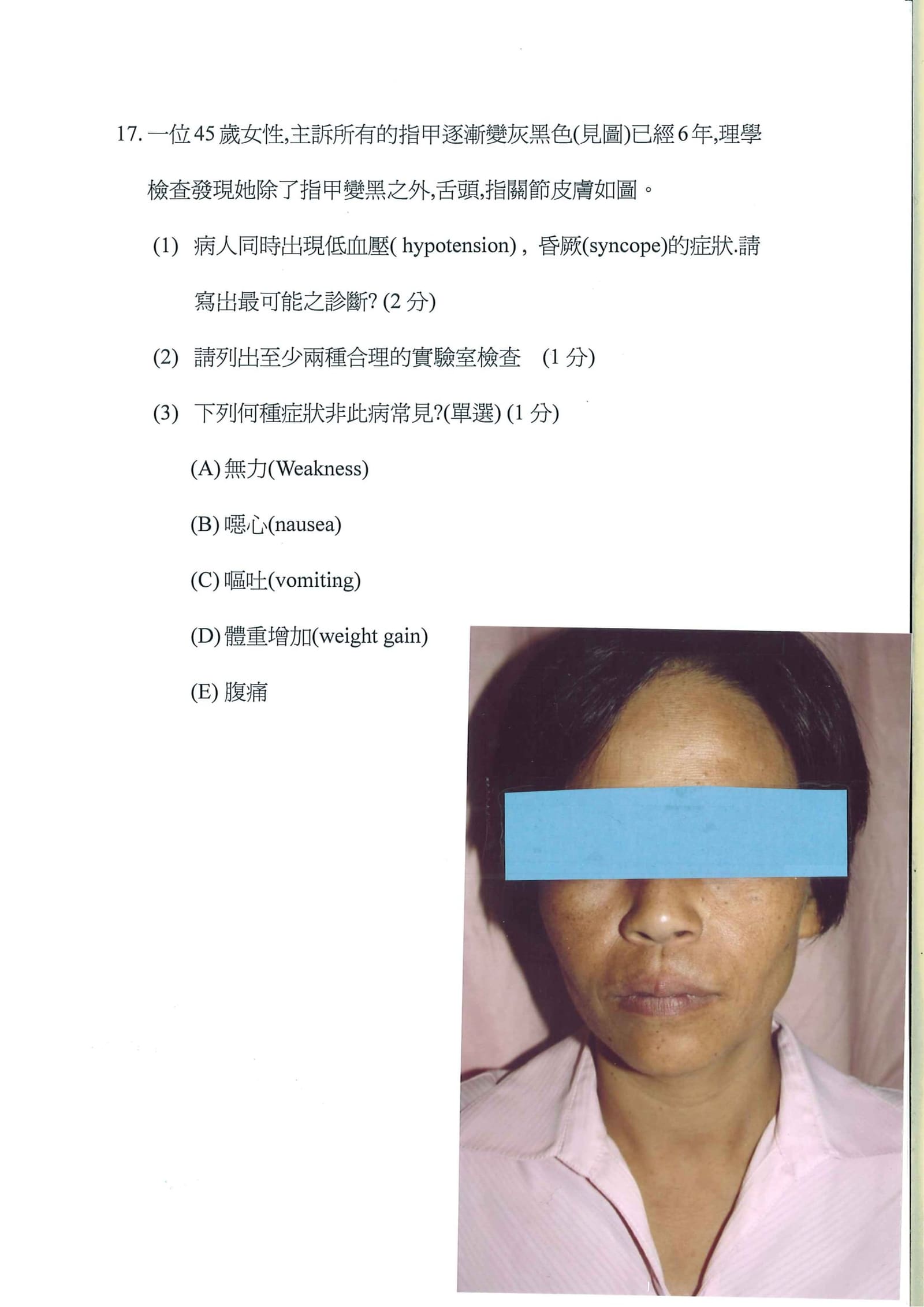 第17題 (p.23)
