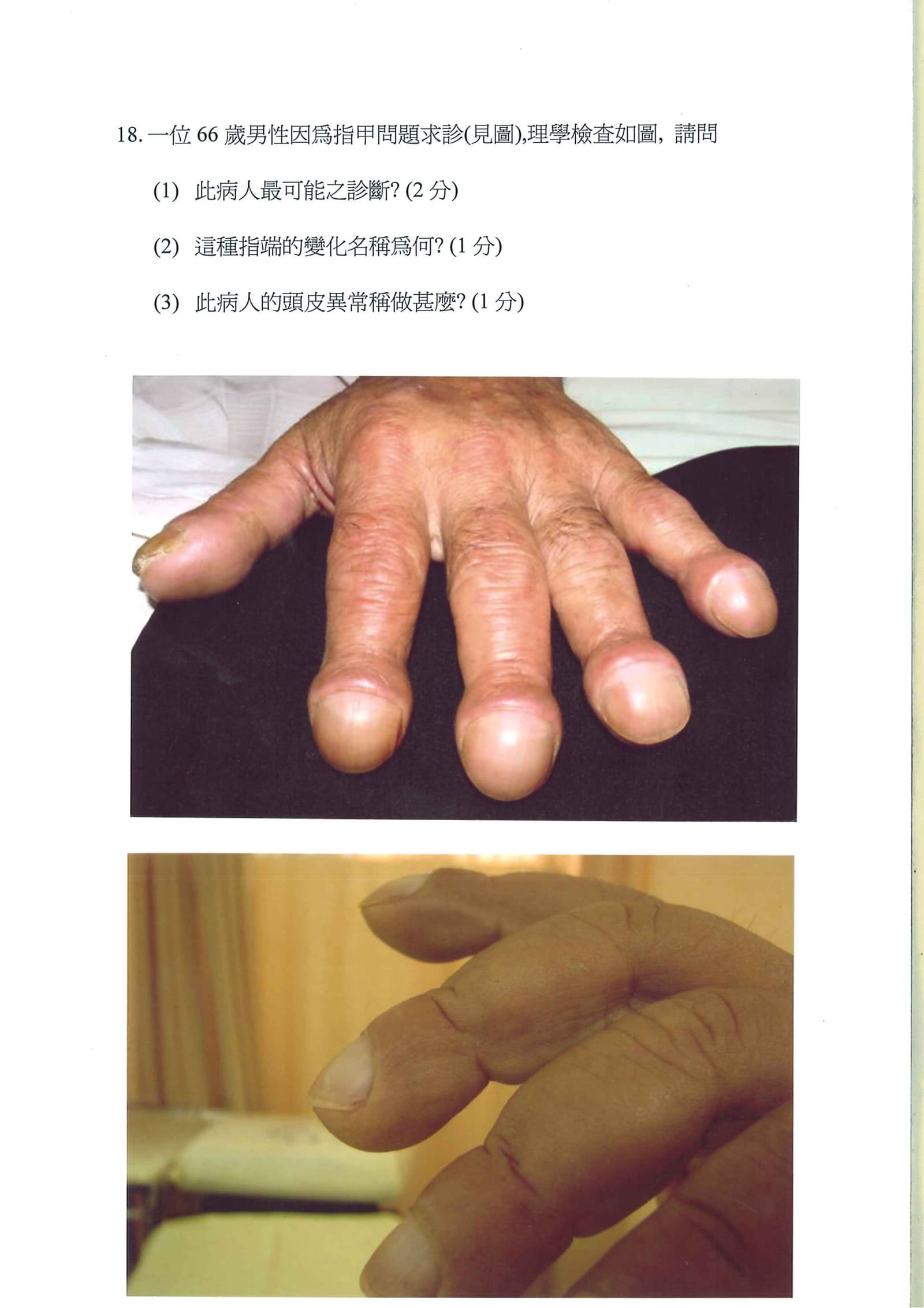 第18題 (p.25)