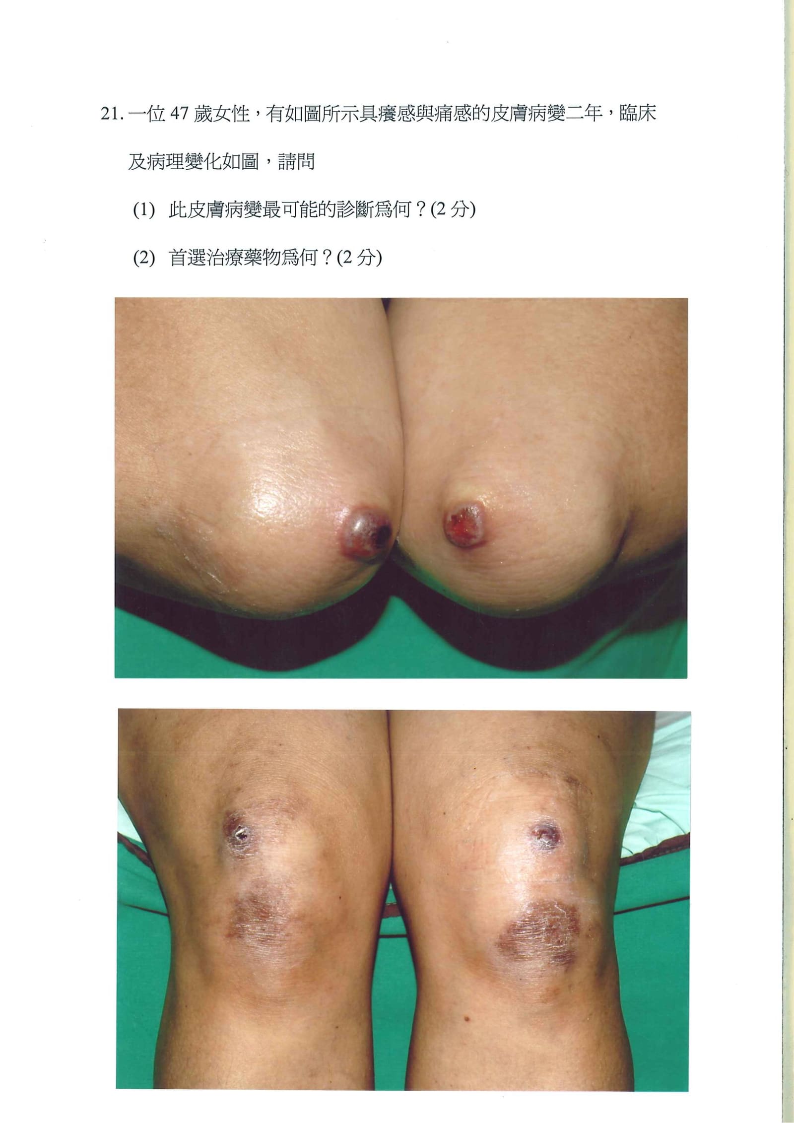 第21題 (p.30)