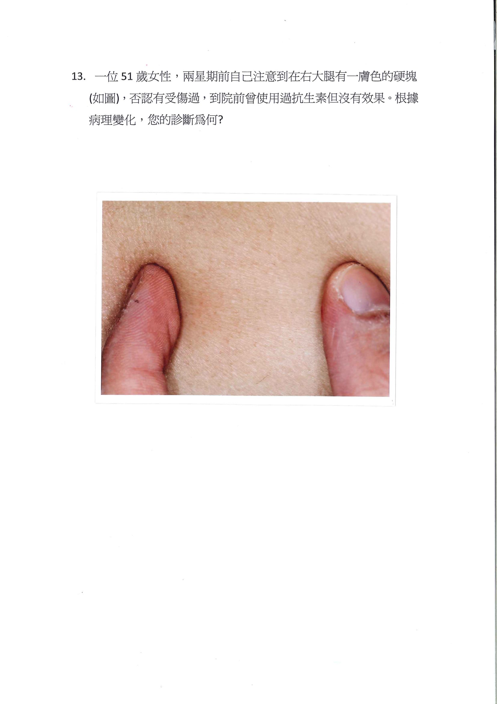 第13題 (p.14)