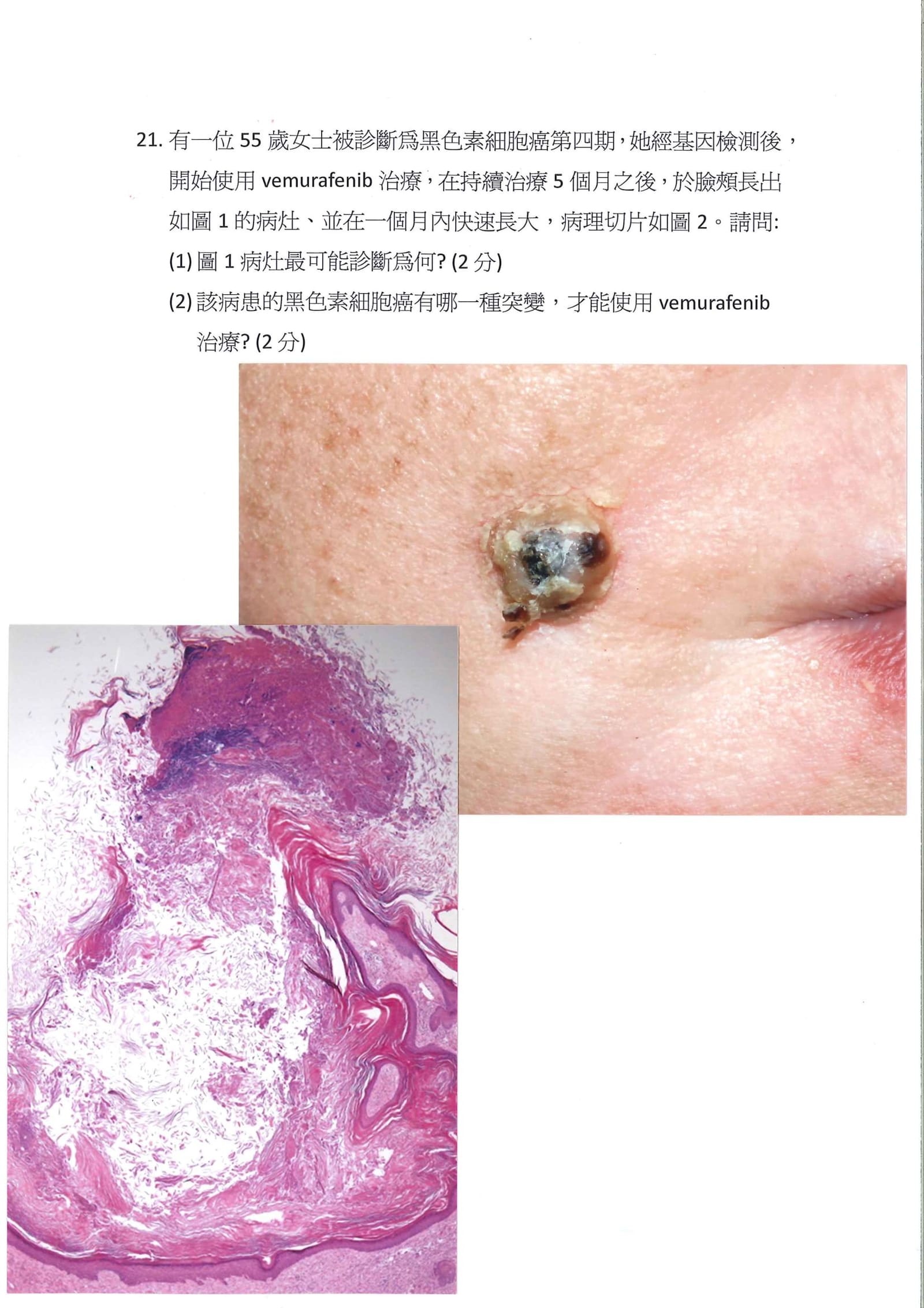 第21題 (p.24)