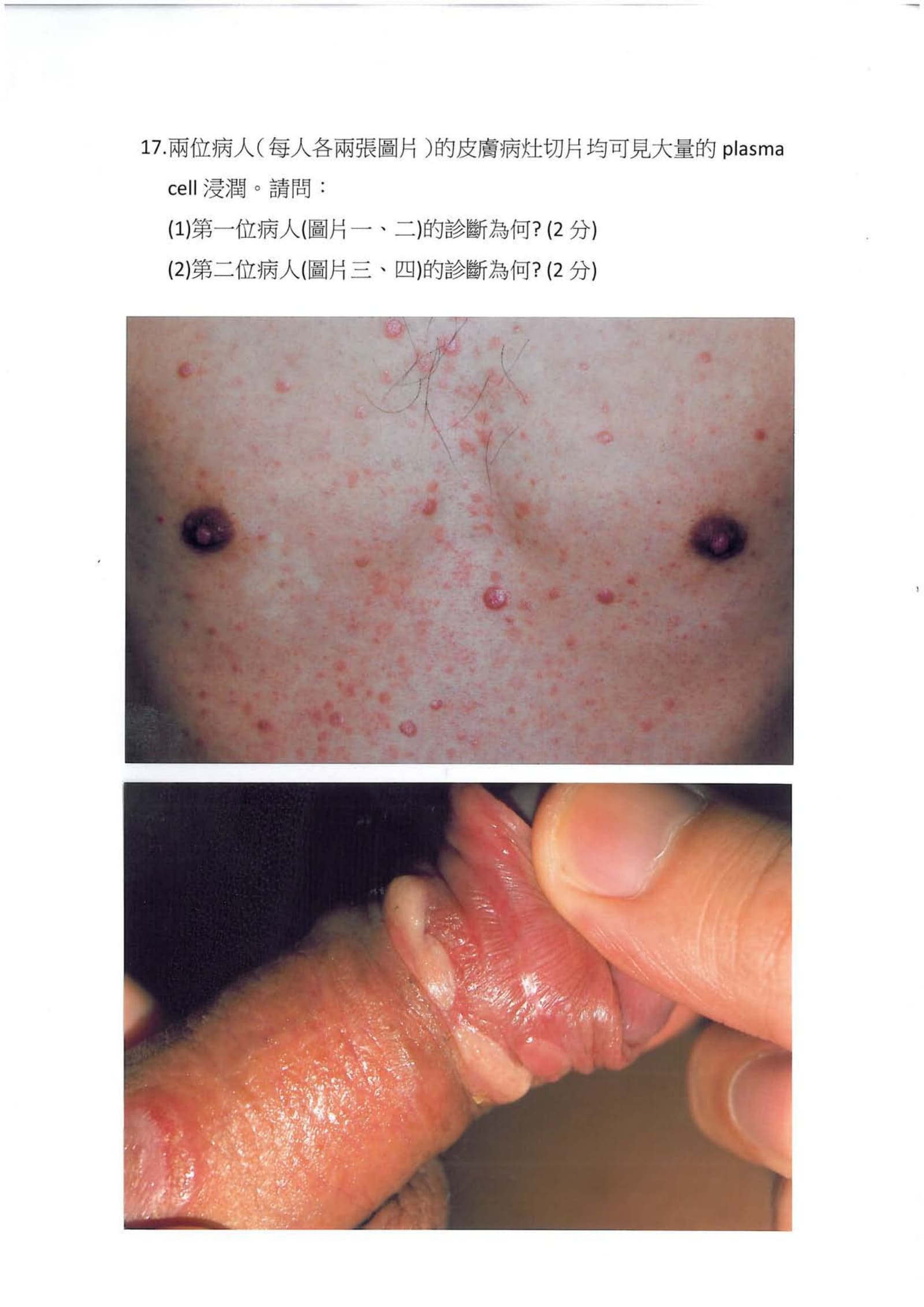 第17題 (p.17)