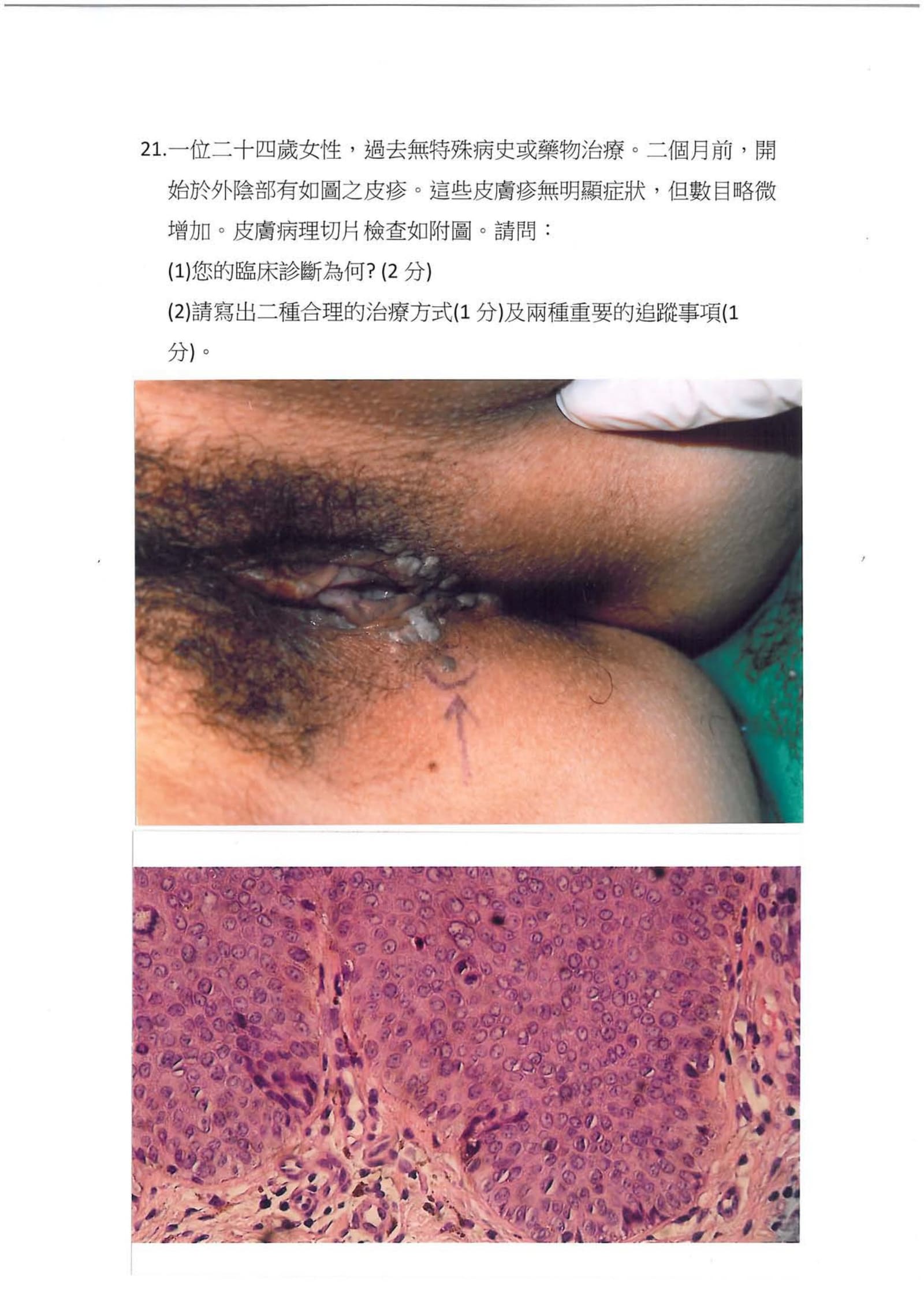第21題 (p.24)
