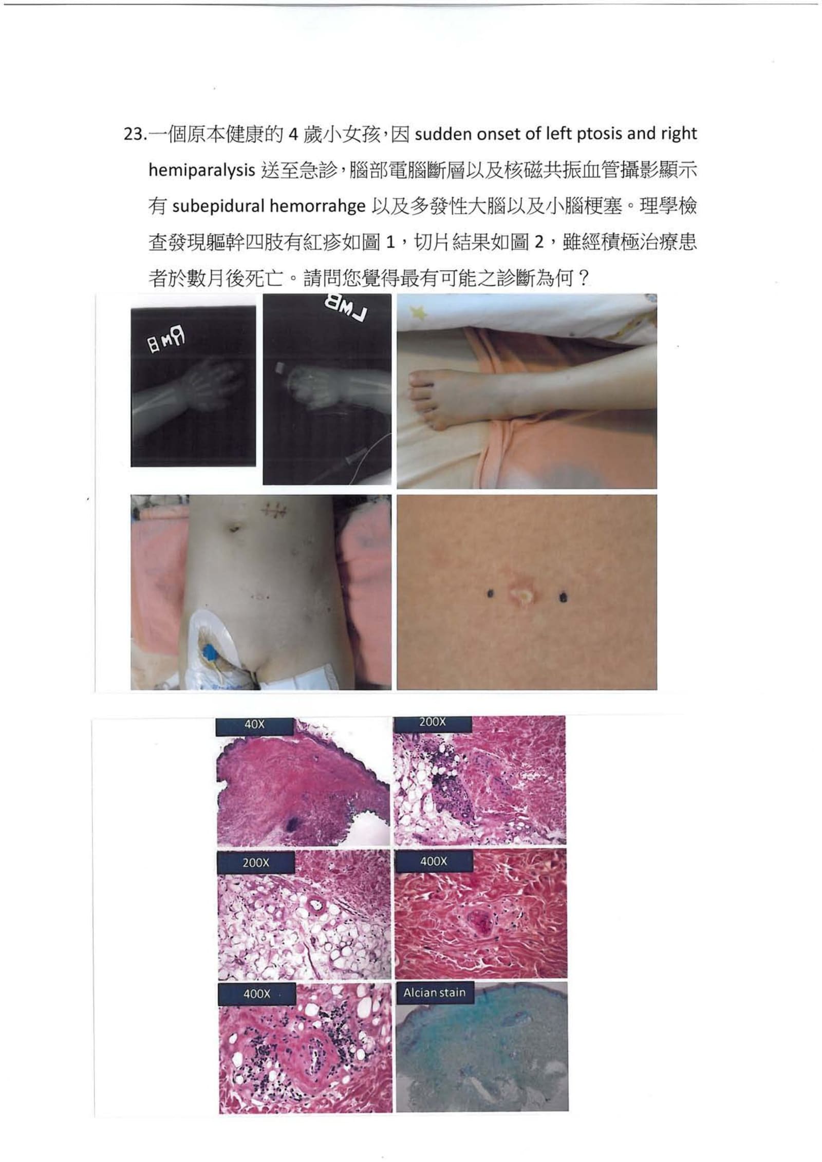 第23題 (p.24)