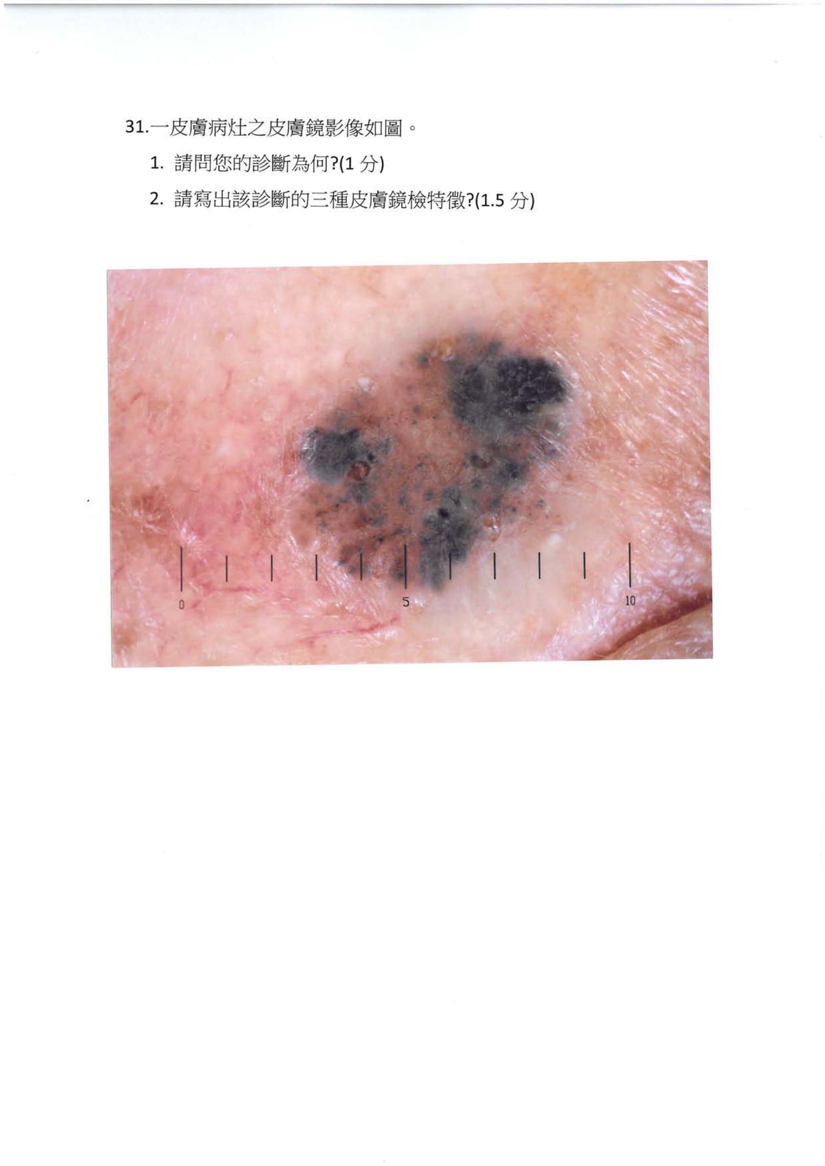 第31題 (p.36)