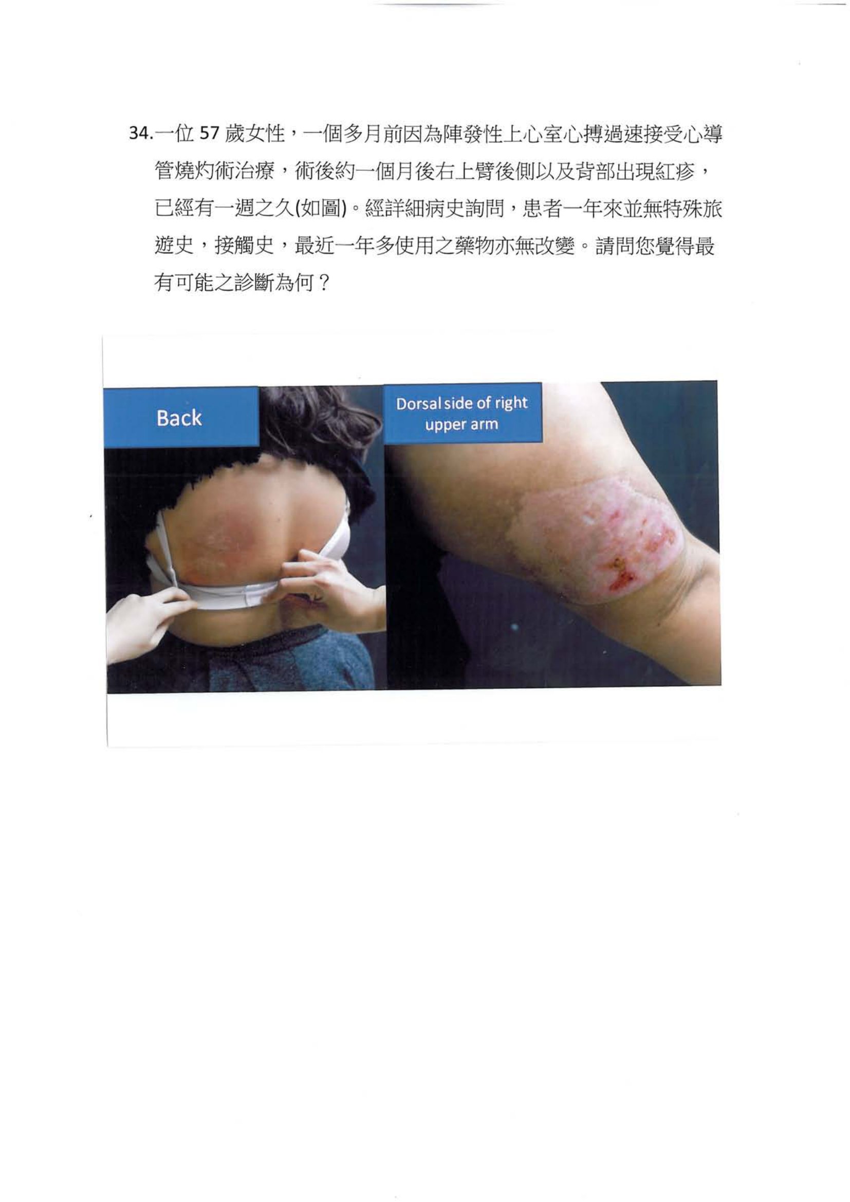 第34題 (p.39)