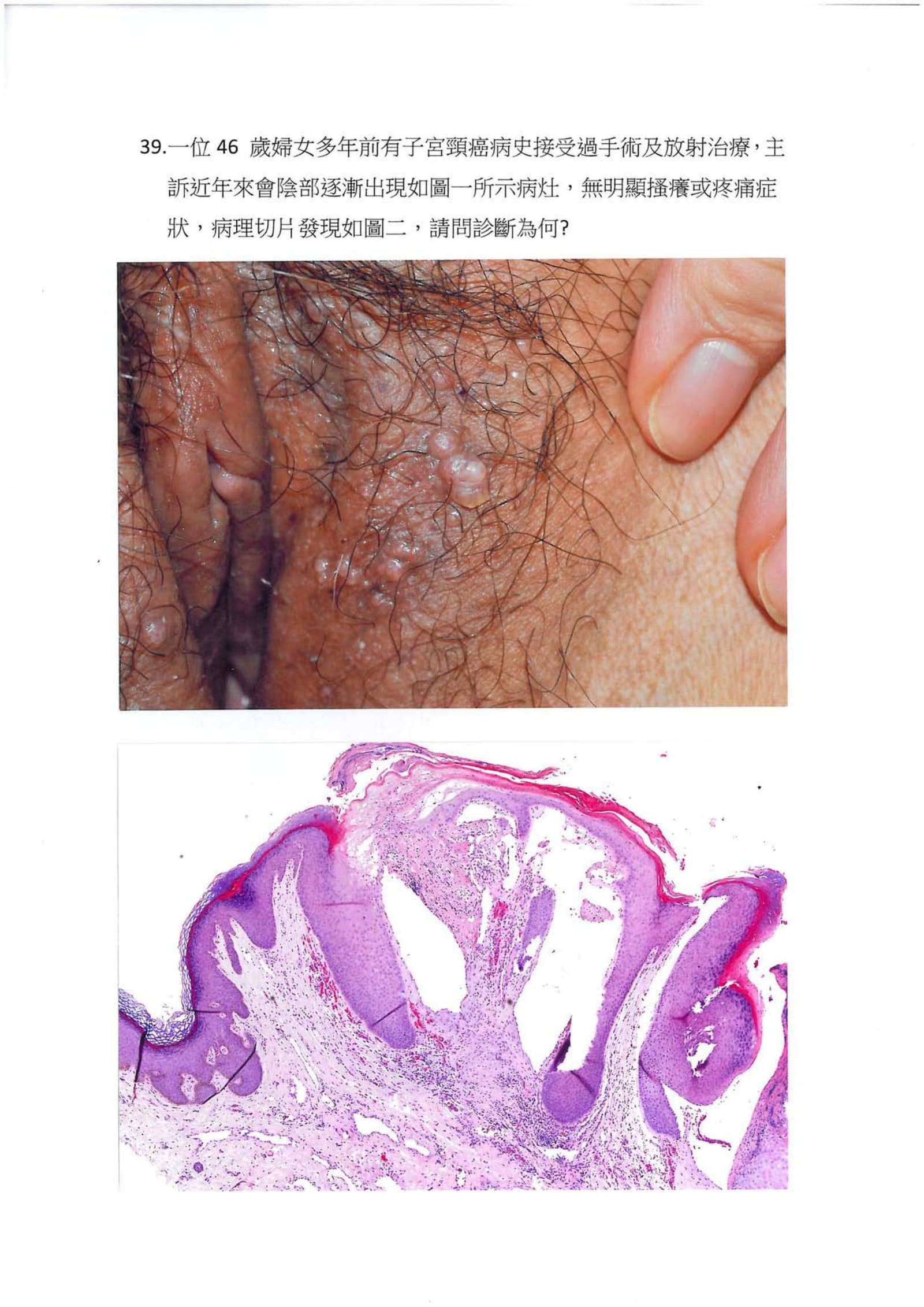 第39題 (p.47)