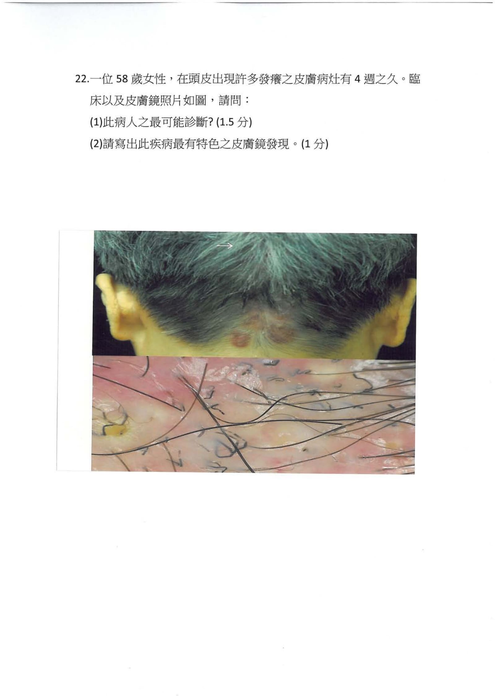 第22題 (p.23)