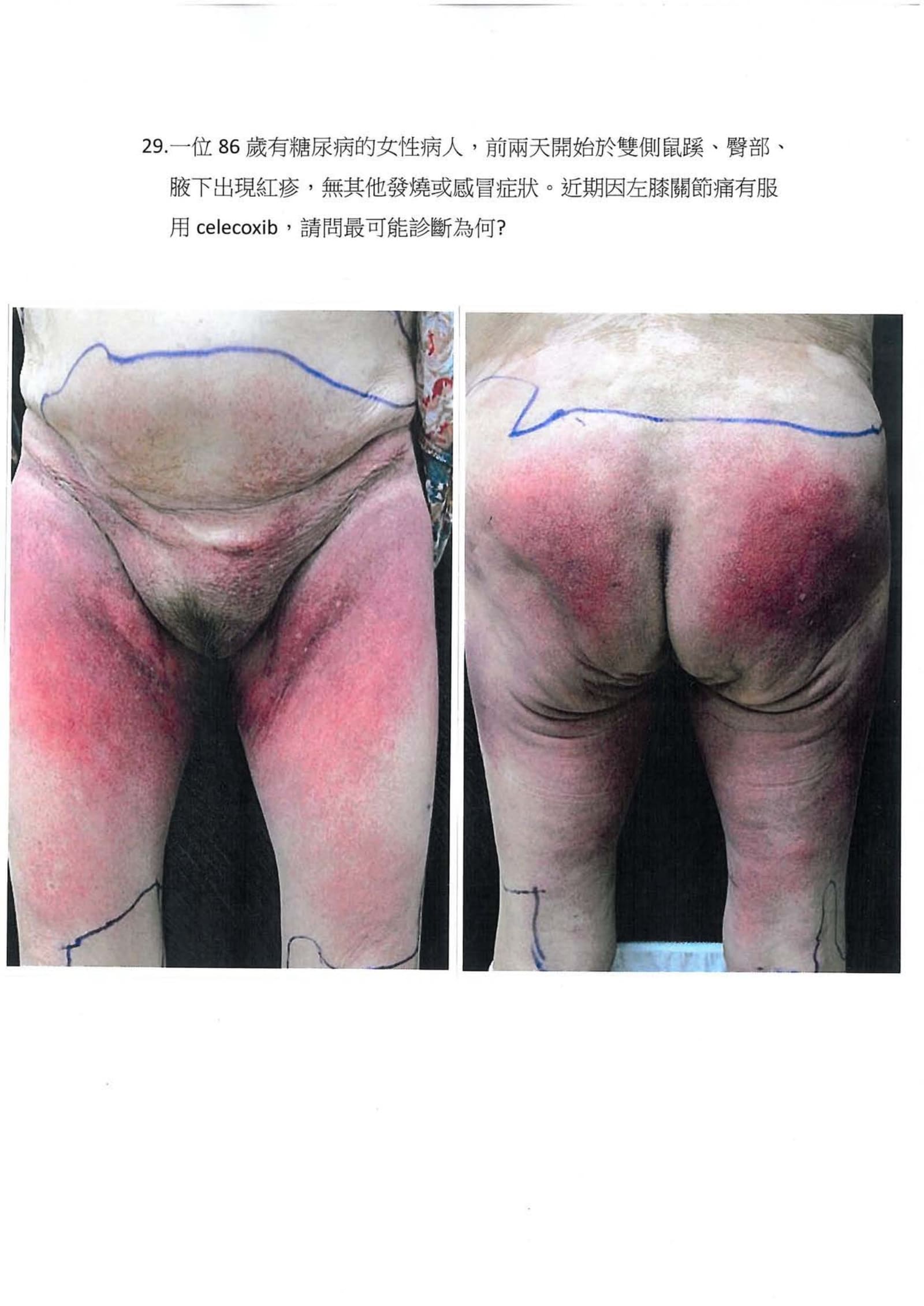 第29題 (p.32)