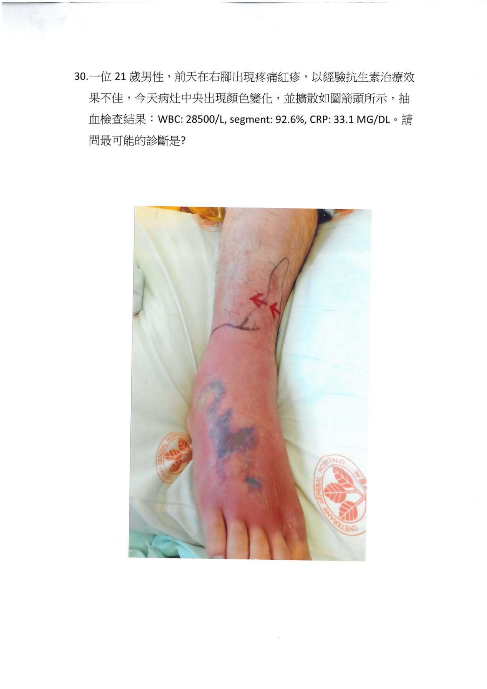 第30題 (p.33)