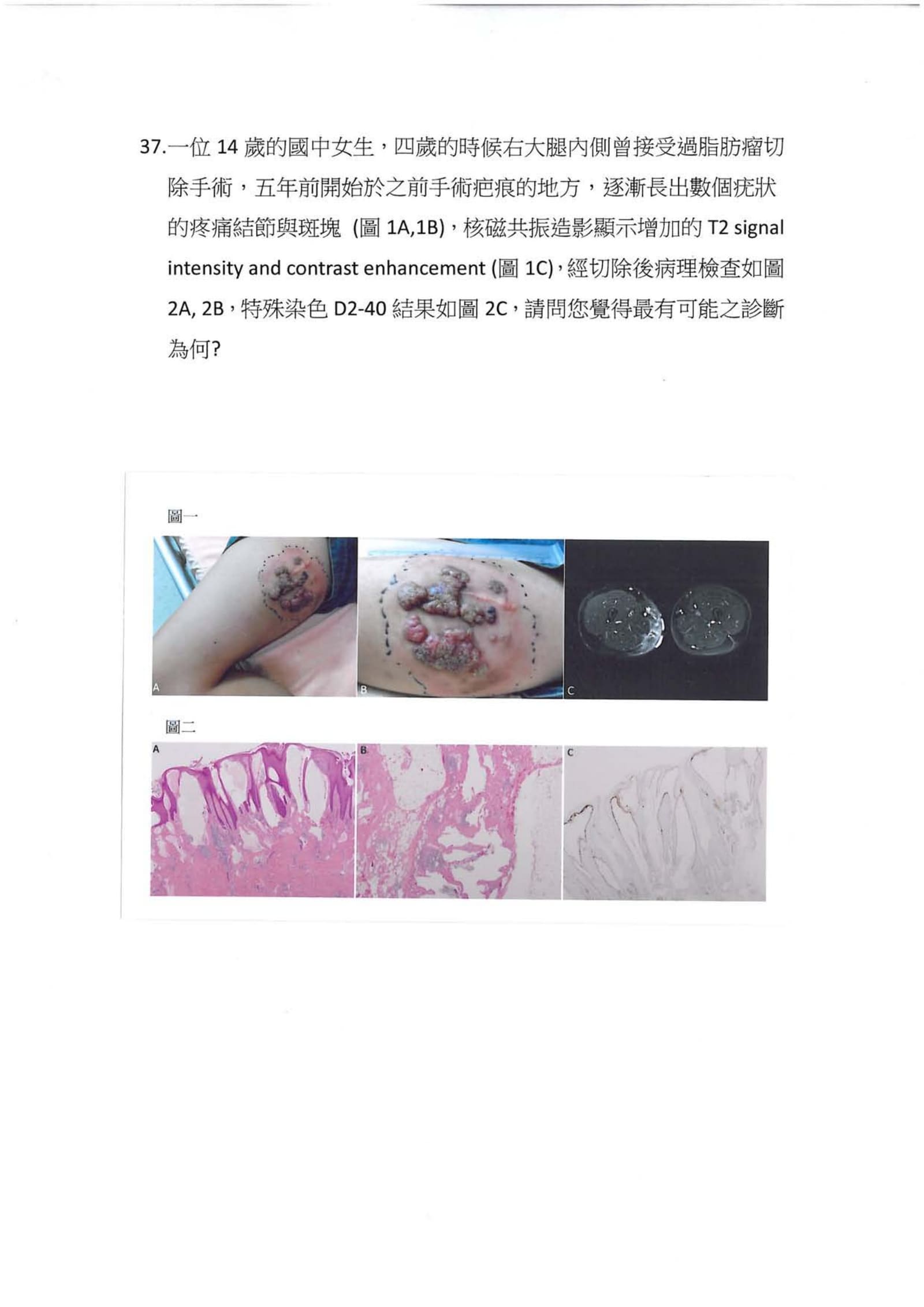 第37題 (p.43)
