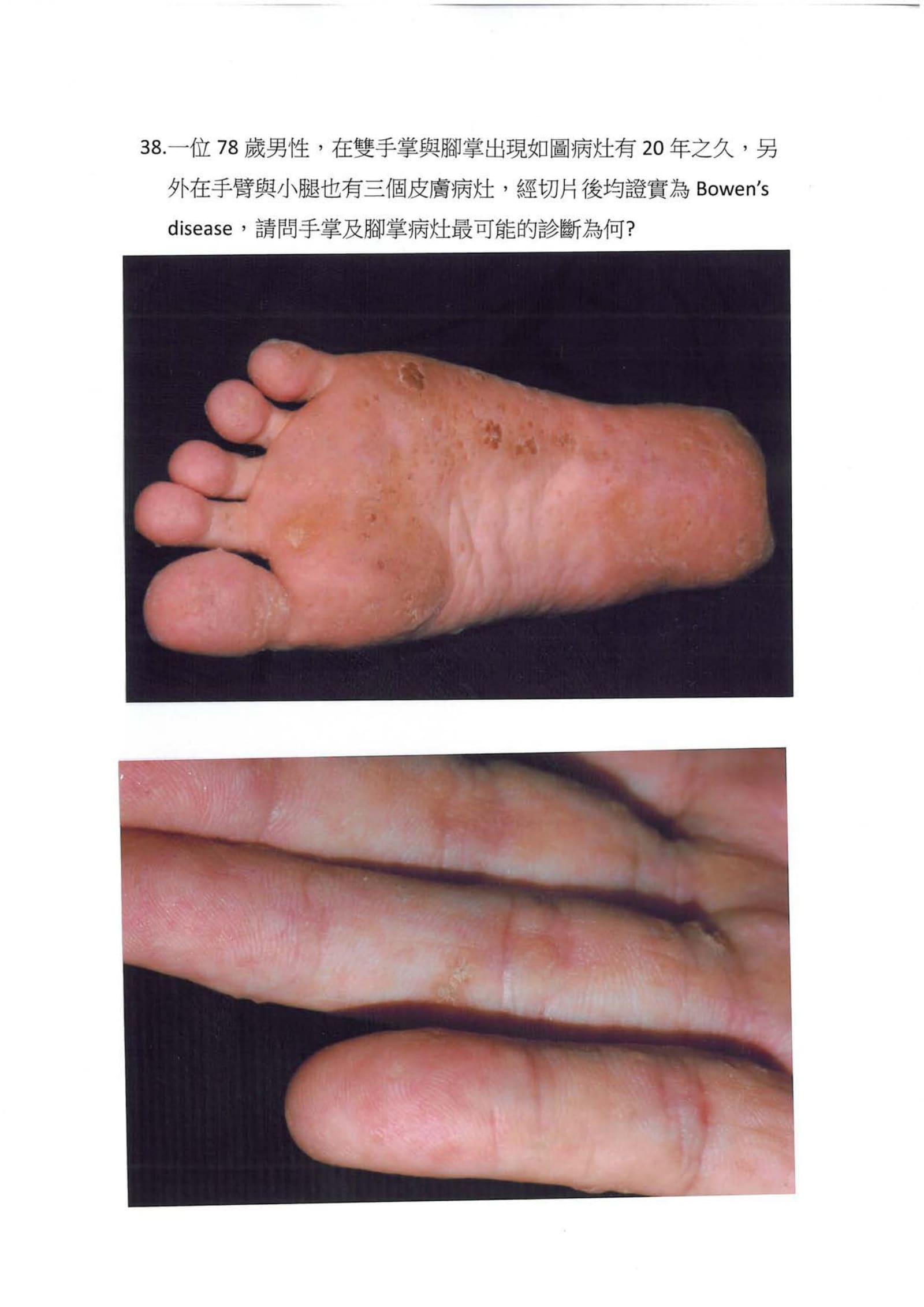 第38題 (p.44)