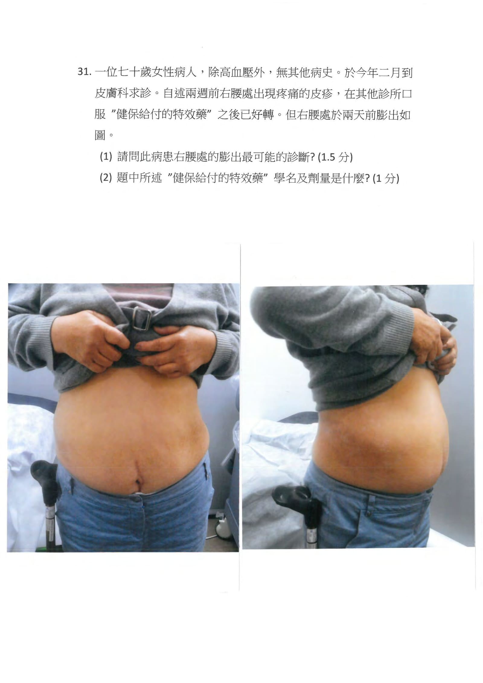 第31題 (p.43)
