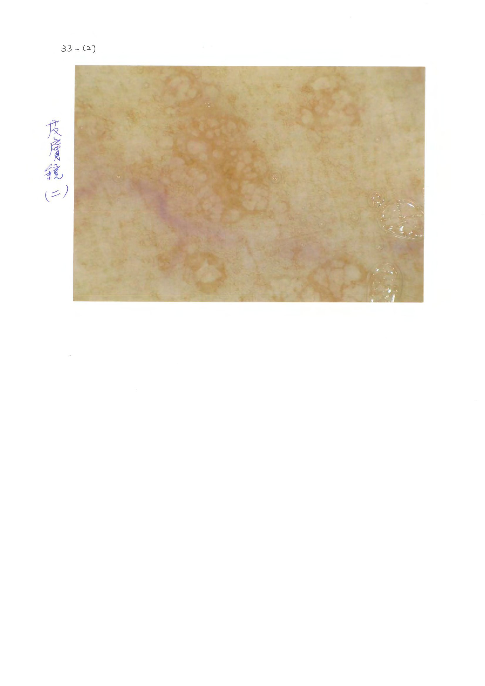 第33題 (p.47)