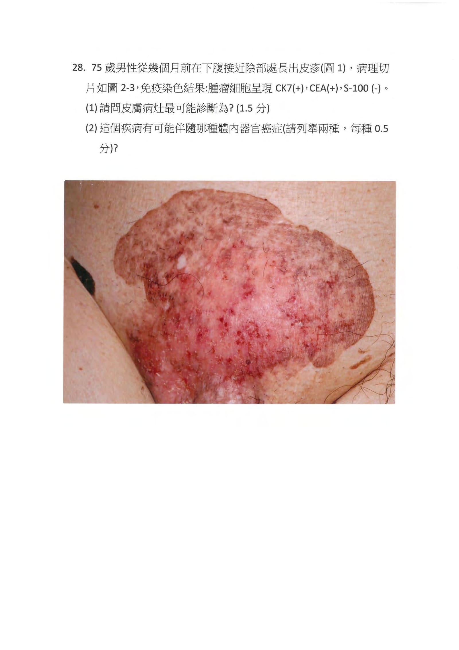 第28題 (p.31)