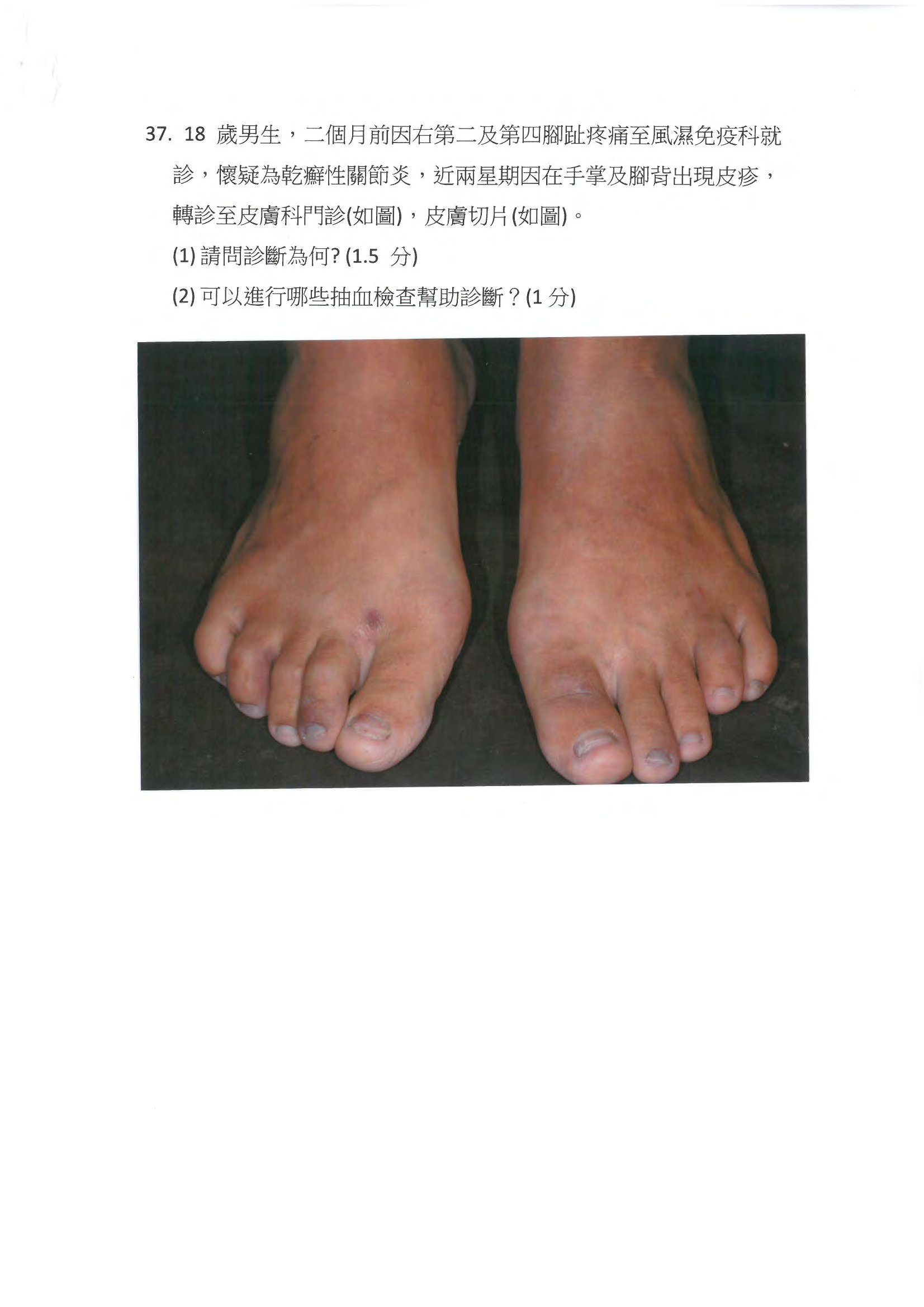 第37題 (p.44)