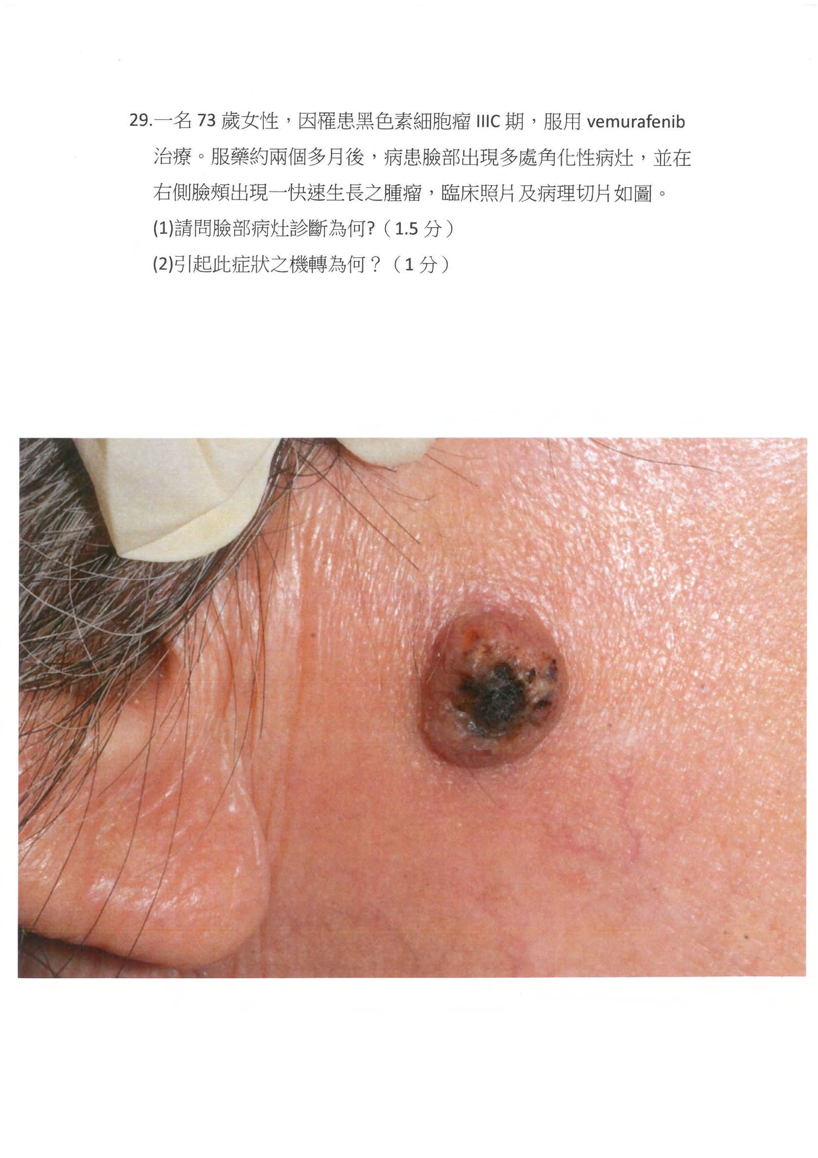 第29題 (p.38)