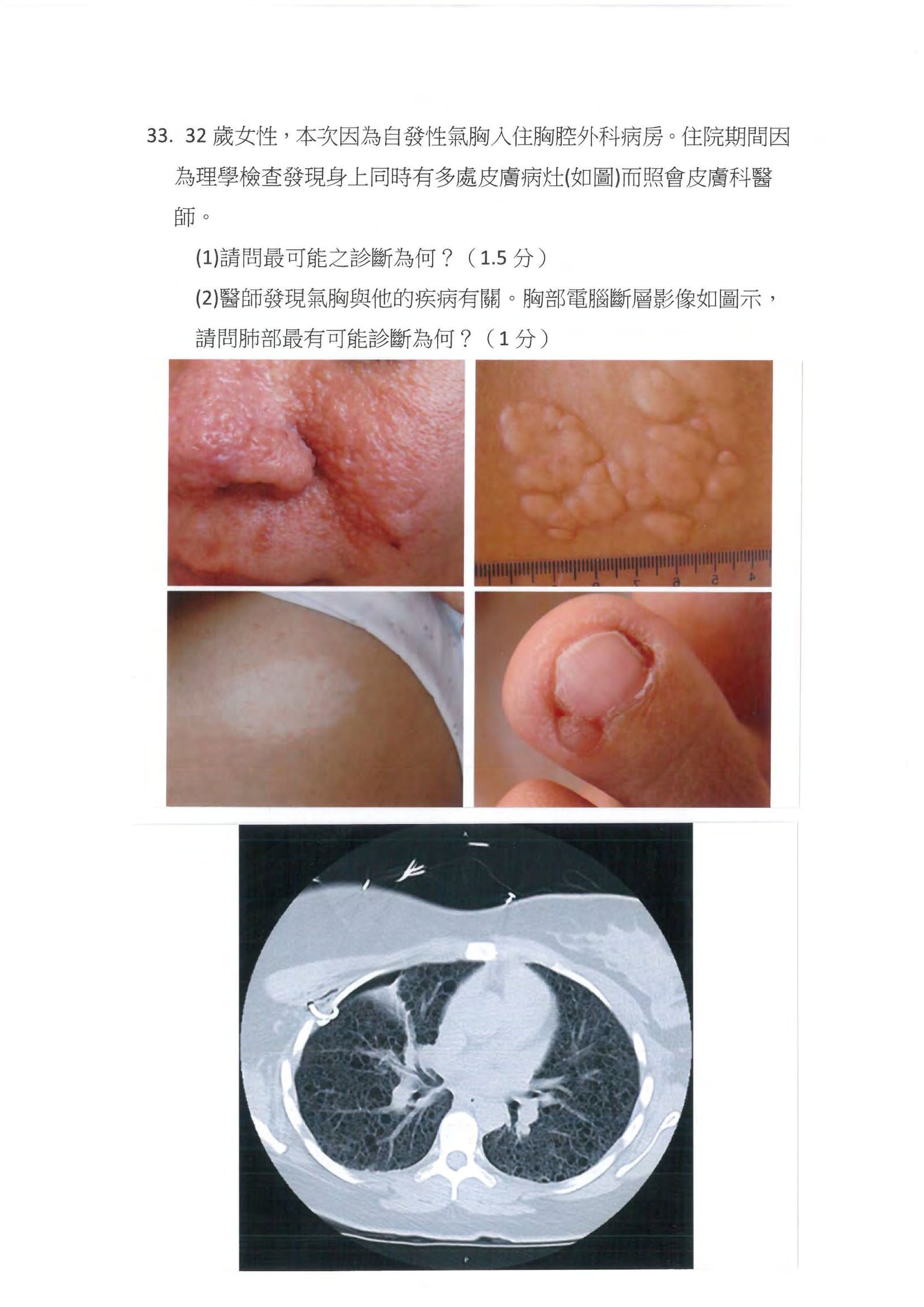 第33題 (p.43)