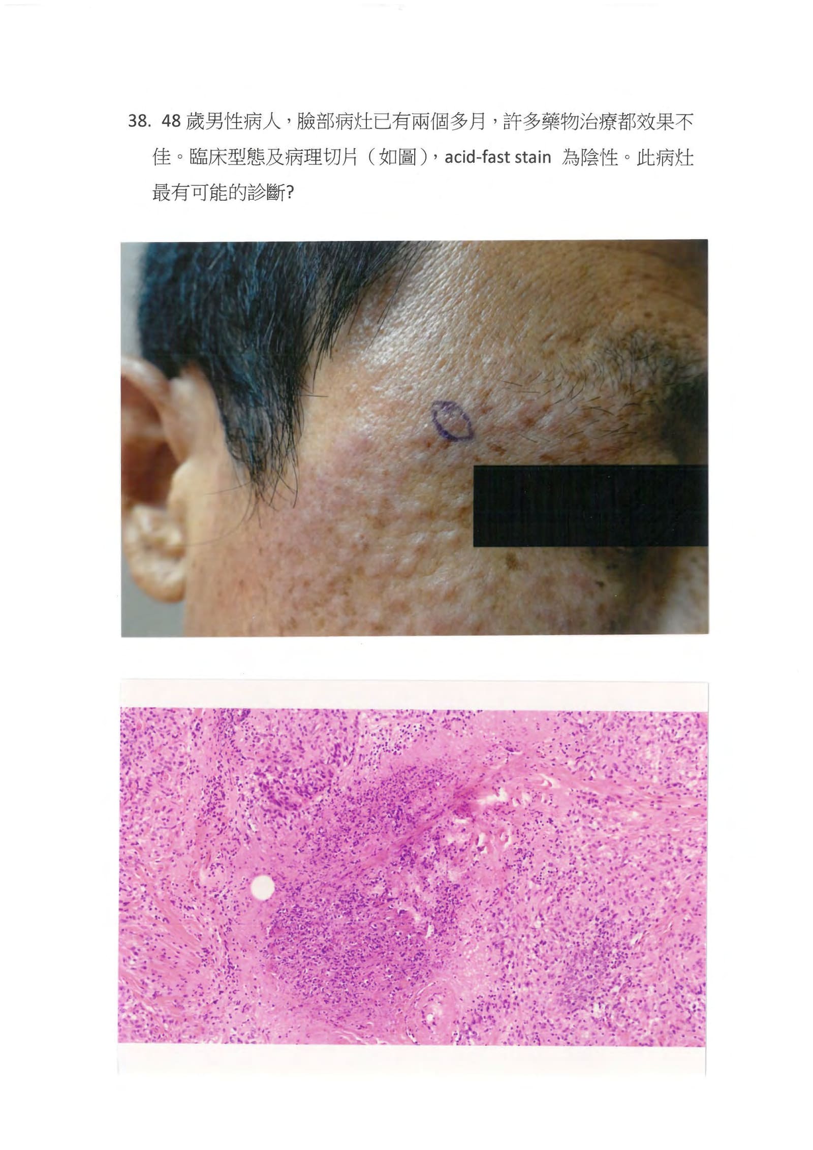 第38題 (p.52)