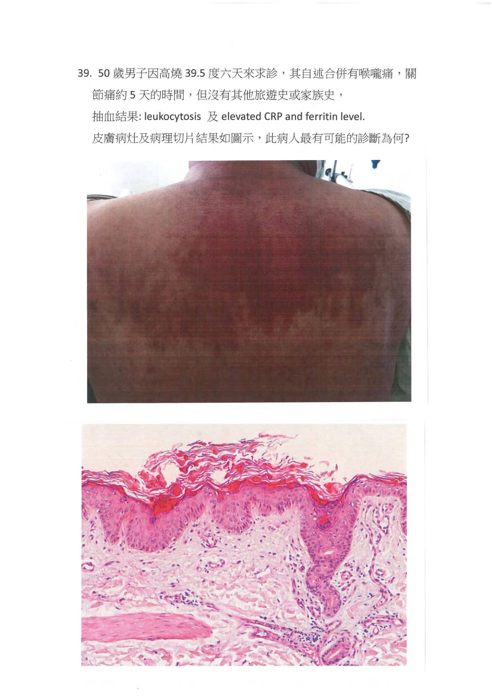 第39題 (p.53)