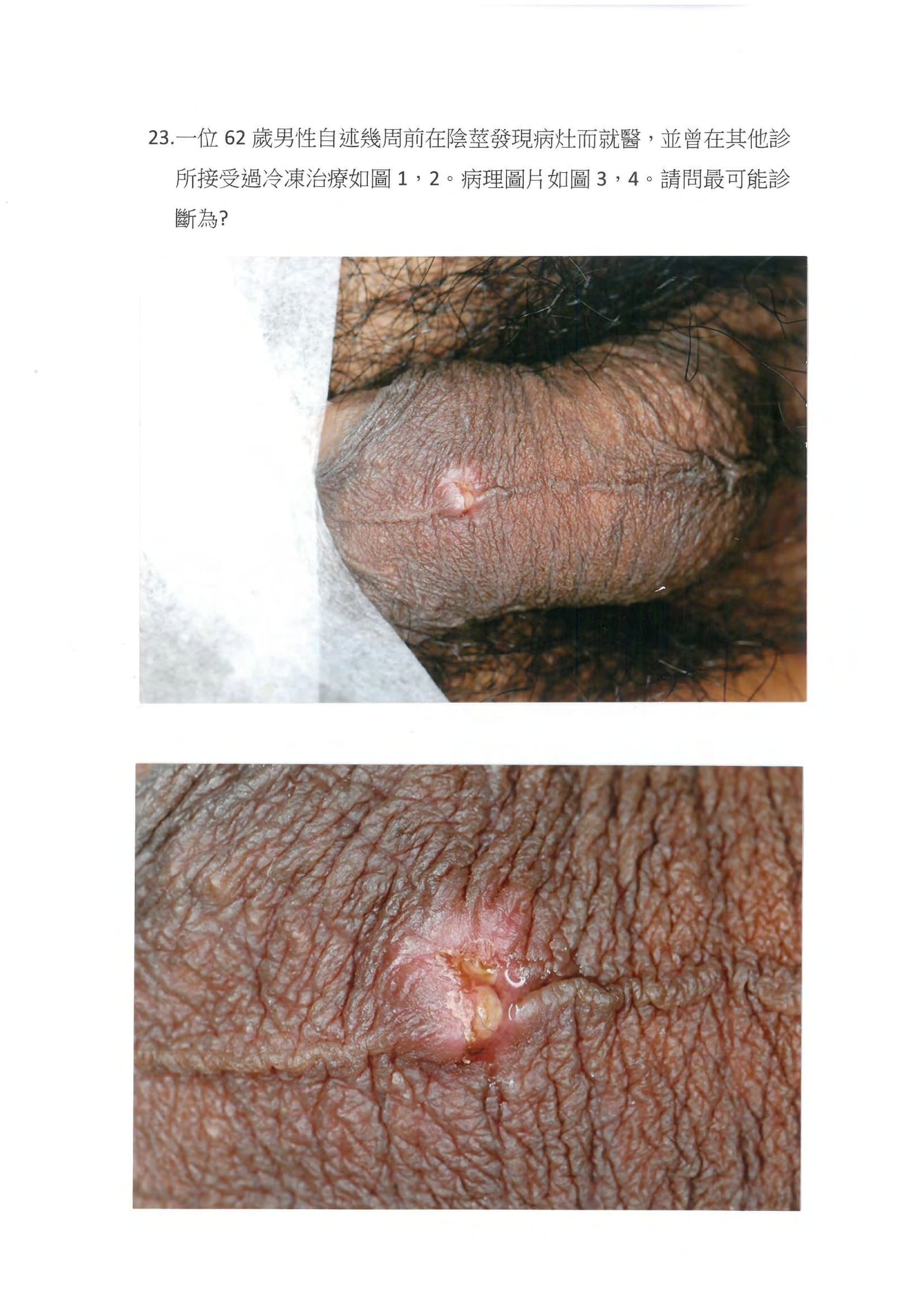 第23題 (p.32)