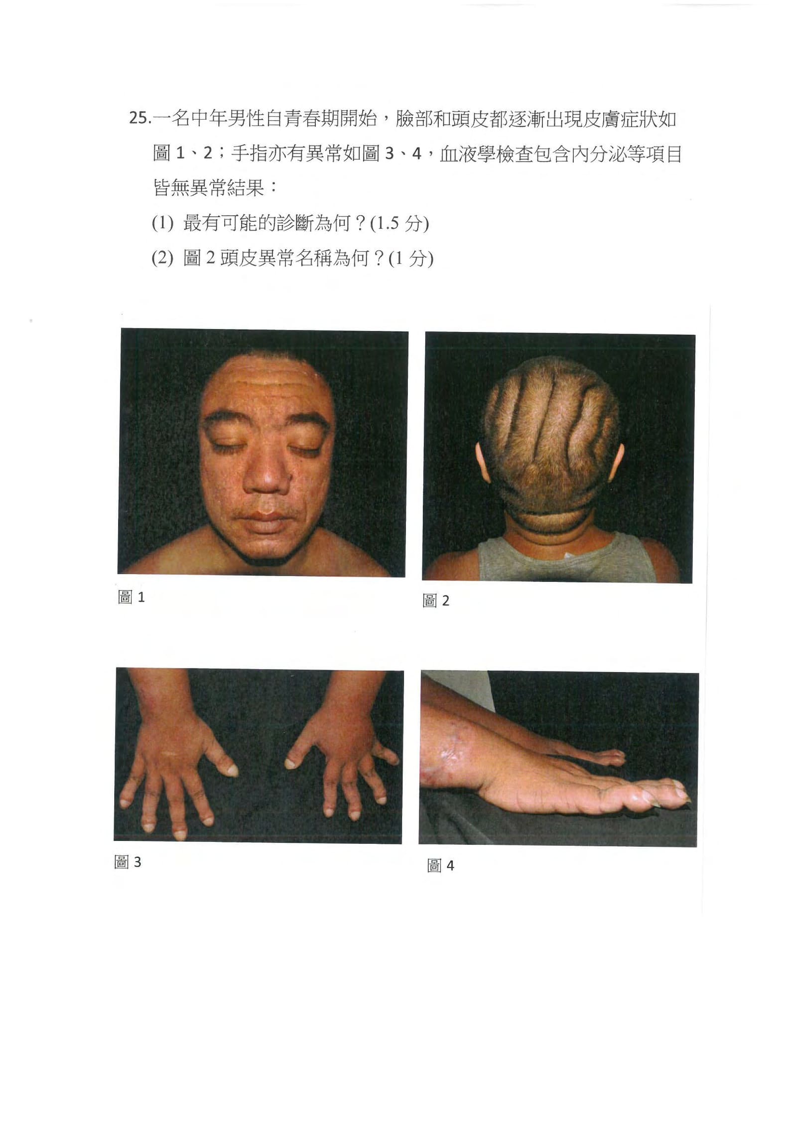 第25題 (p.35)