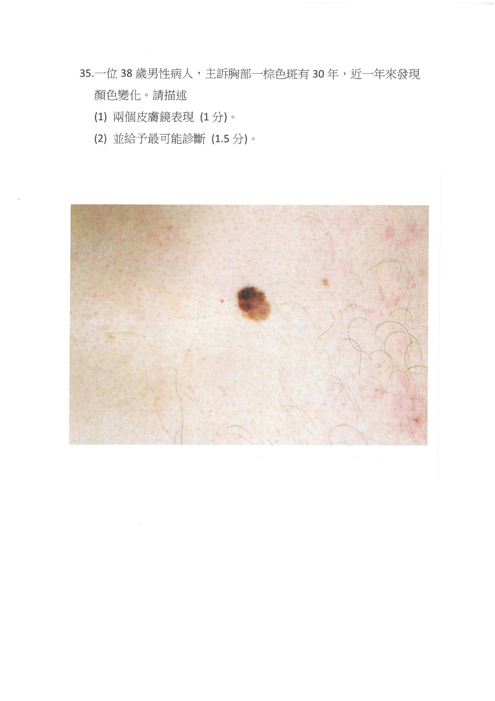 第35題 (p.51)