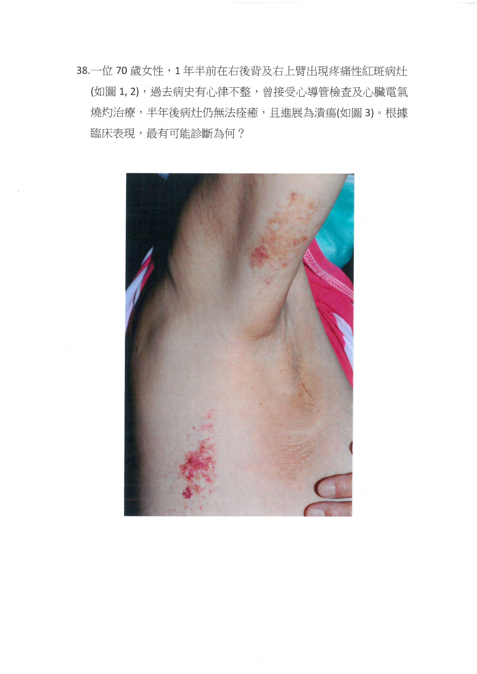 第38題 (p.55)