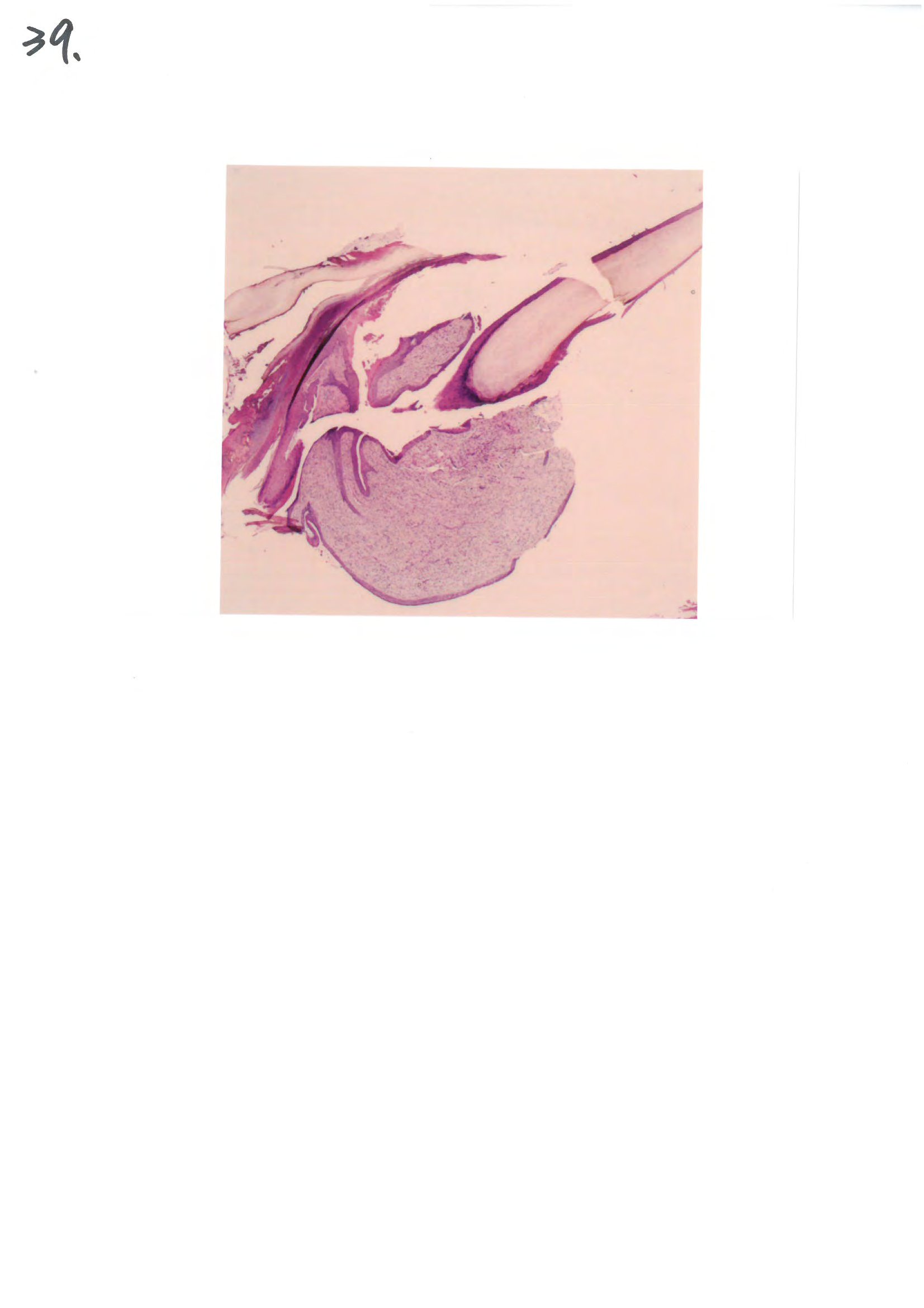 第39題 (p.58)