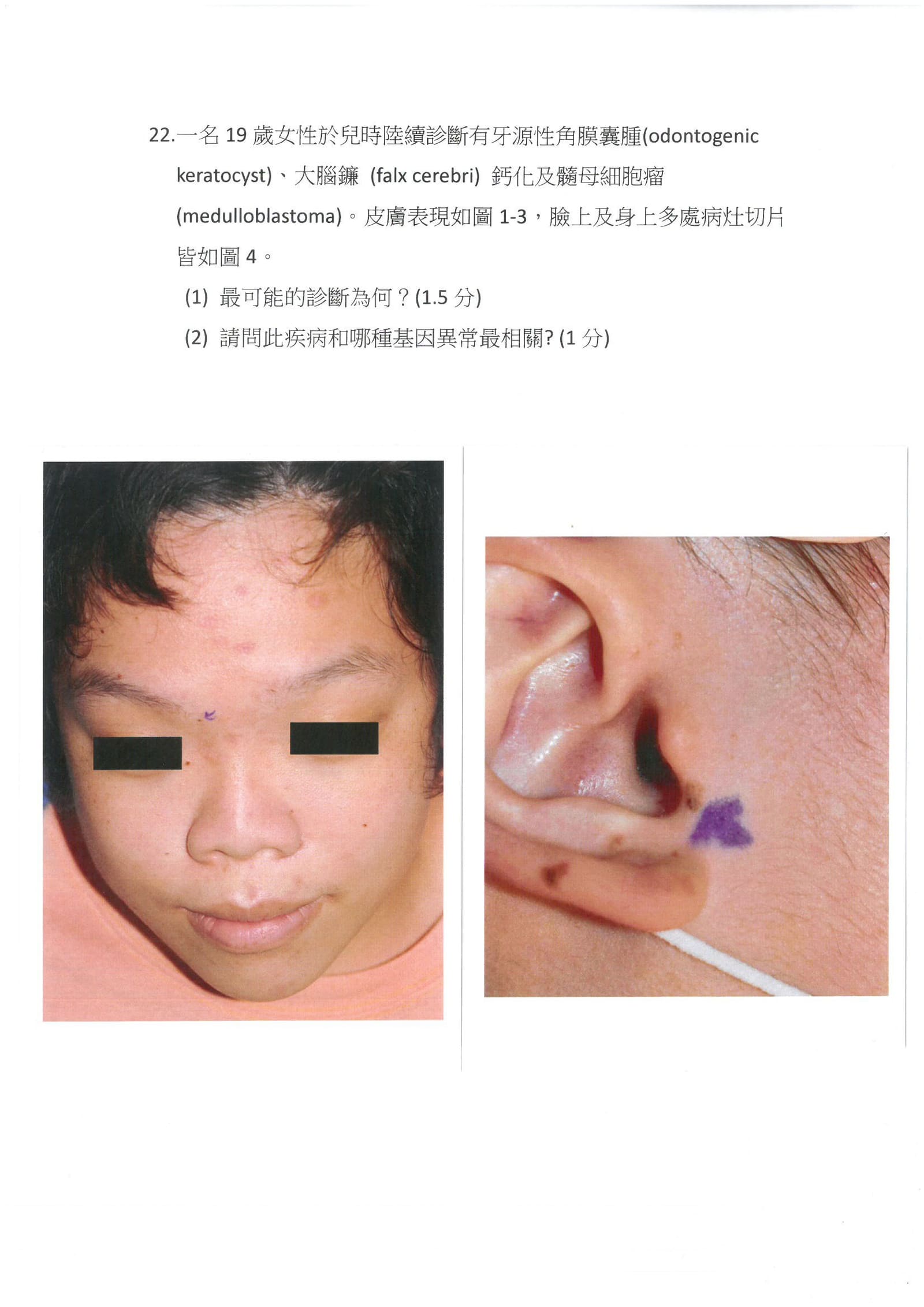 第22題 (p.25)