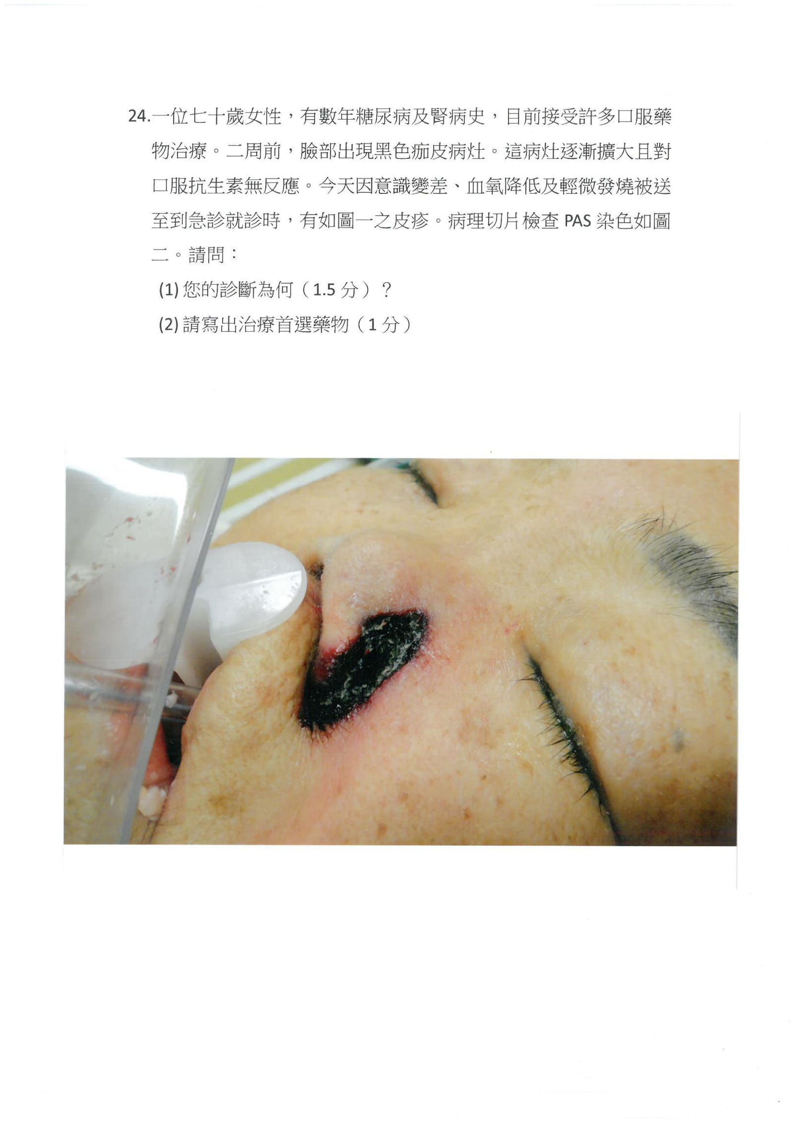 第24題 (p.30)