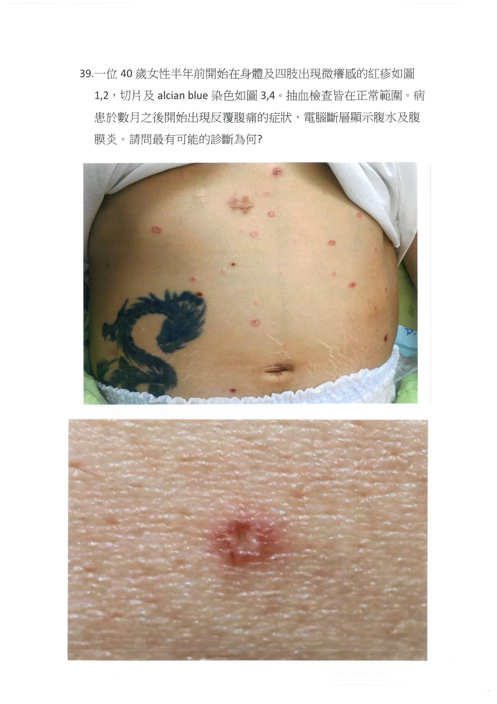 第39題 (p.58)