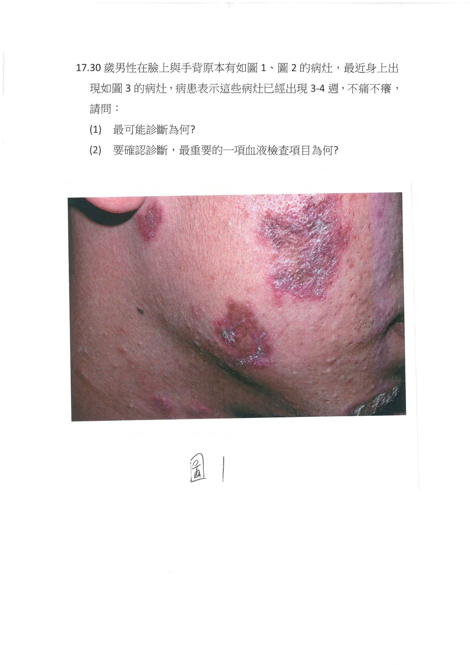 第17題 (p.17)