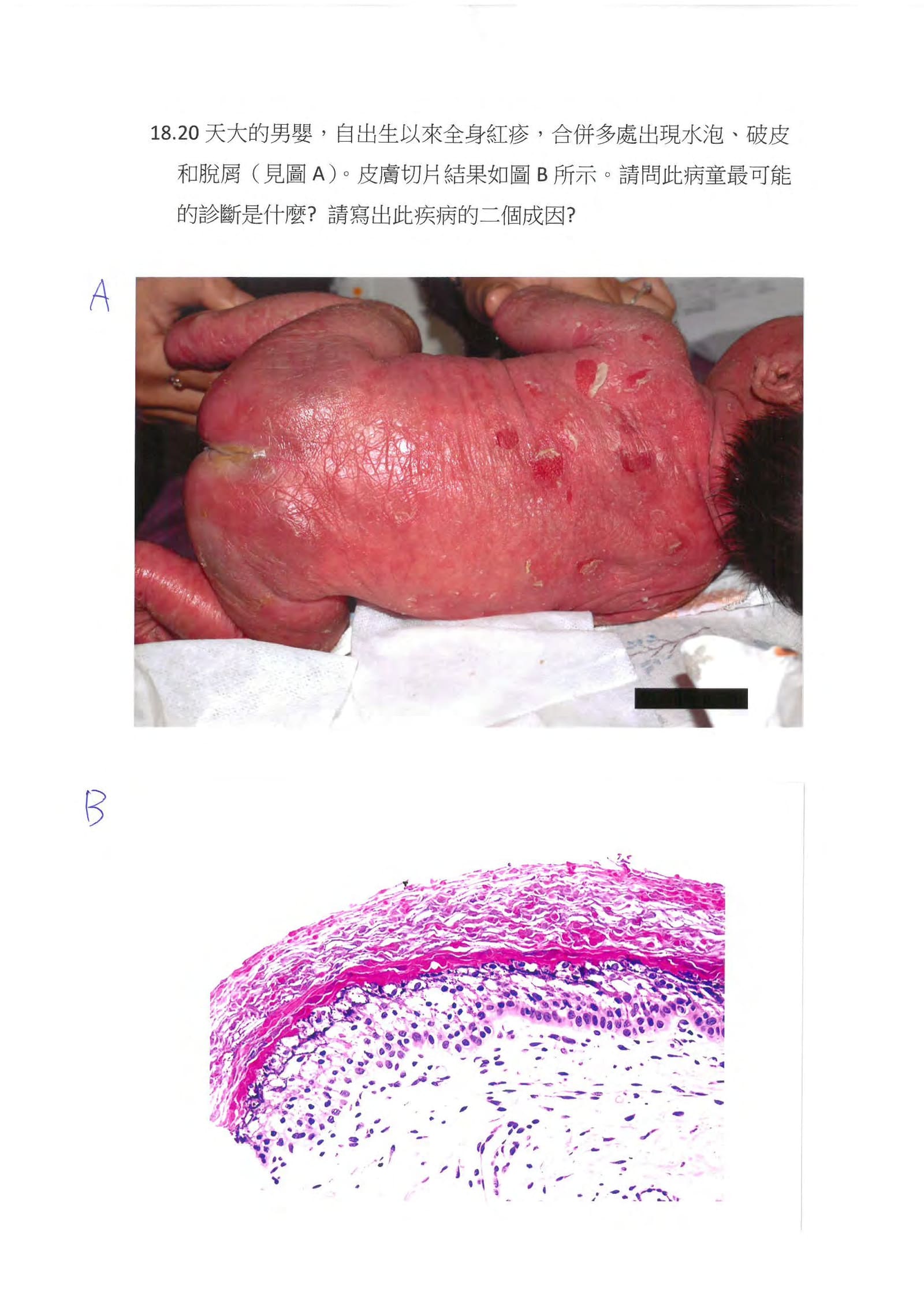 第18題 (p.19)