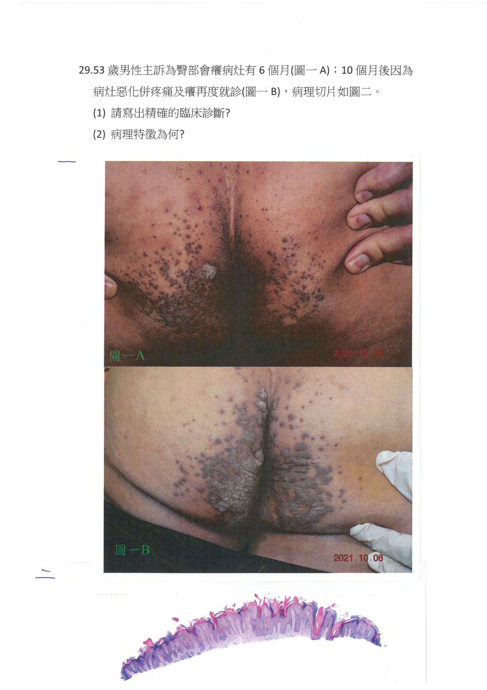 第29題 (p.37)