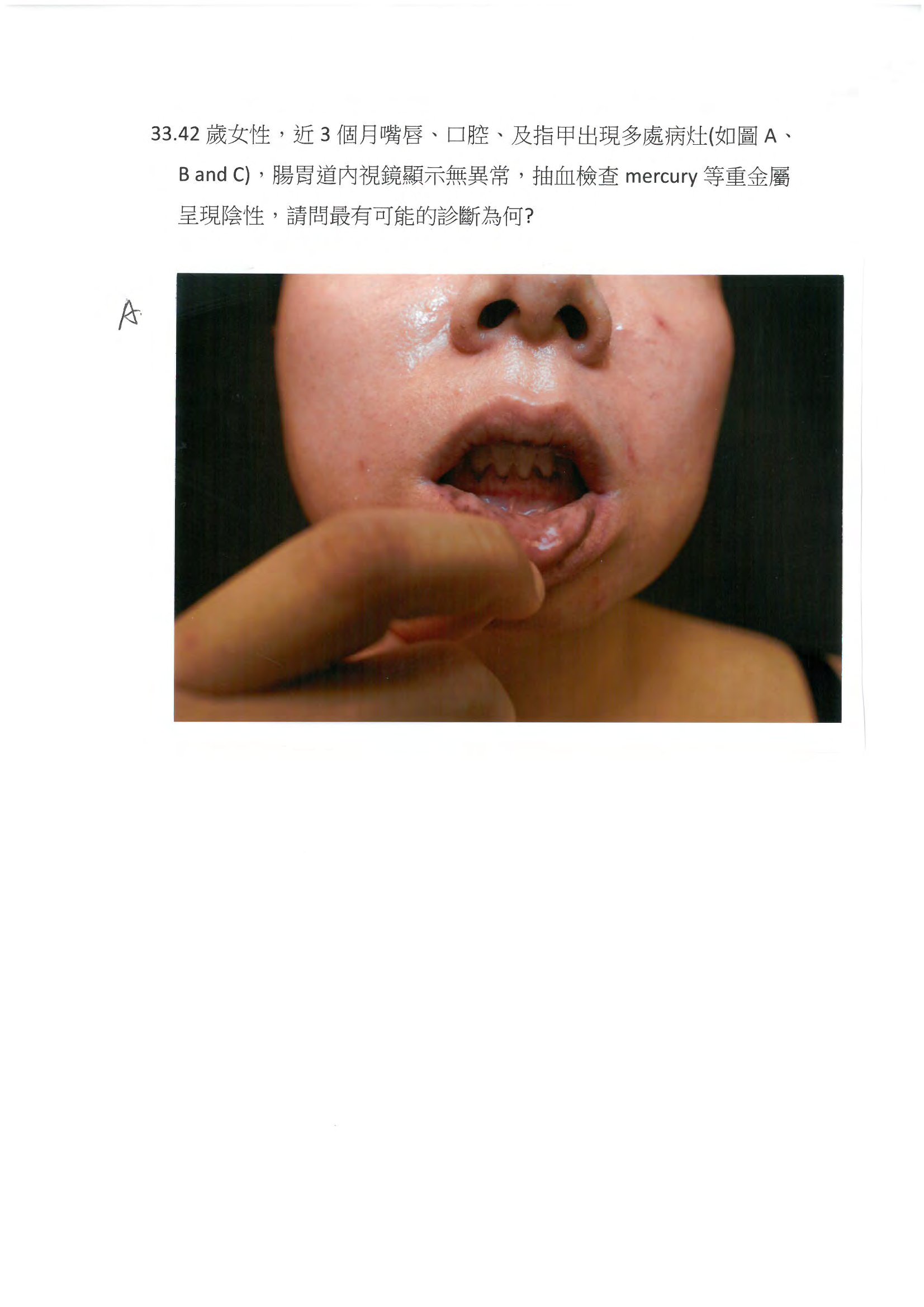 第33題 (p.43)