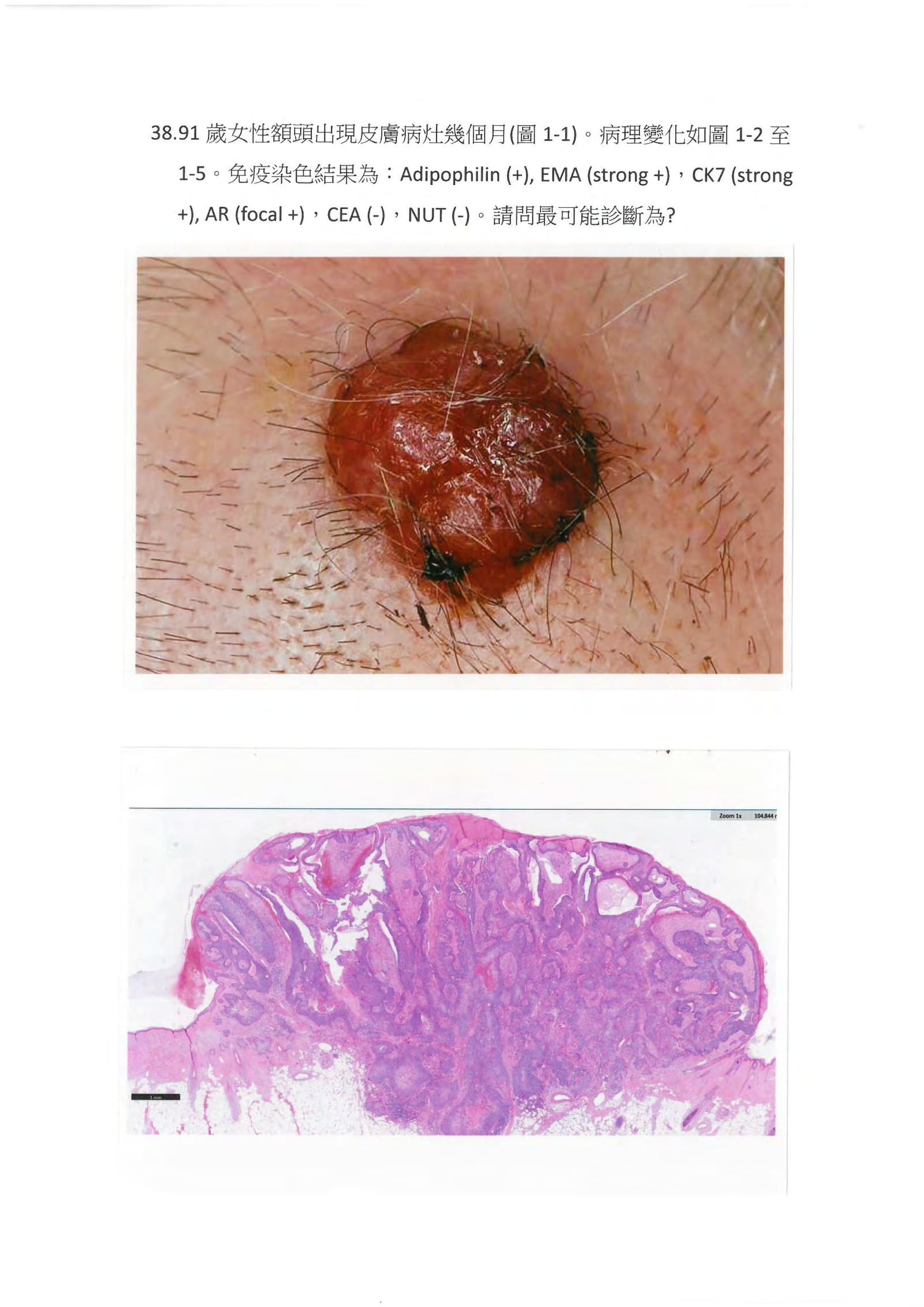 第38題 (p.51)