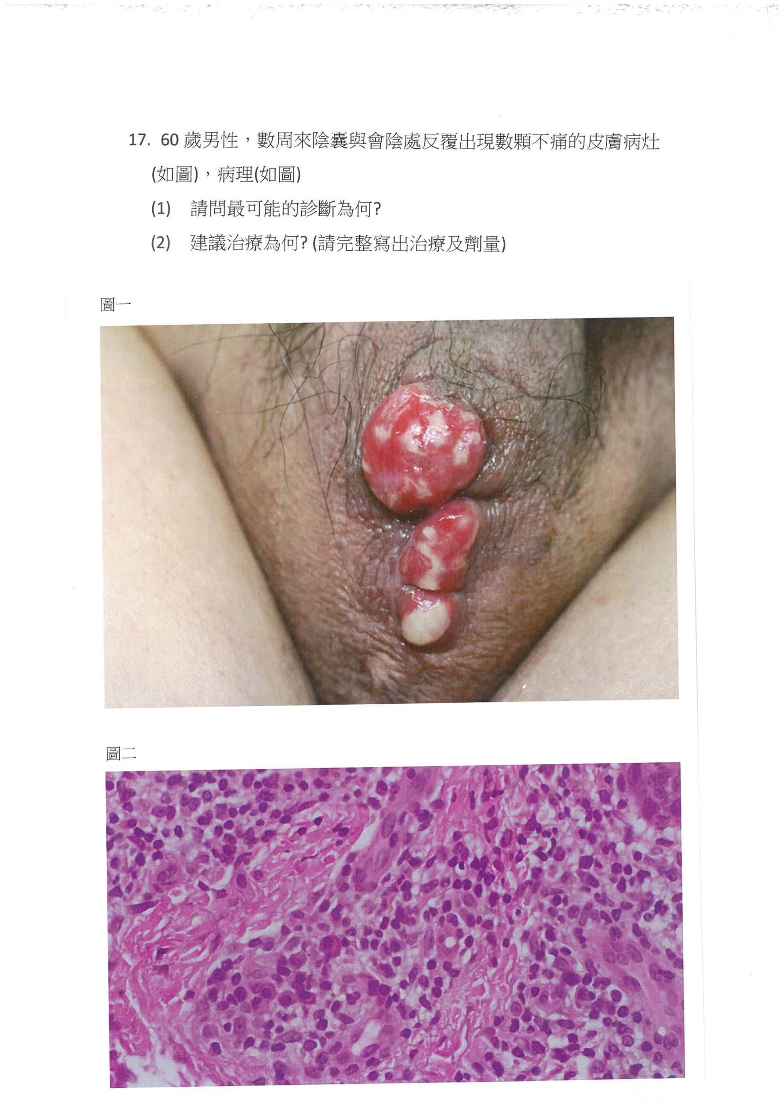 第17題 (p.17)