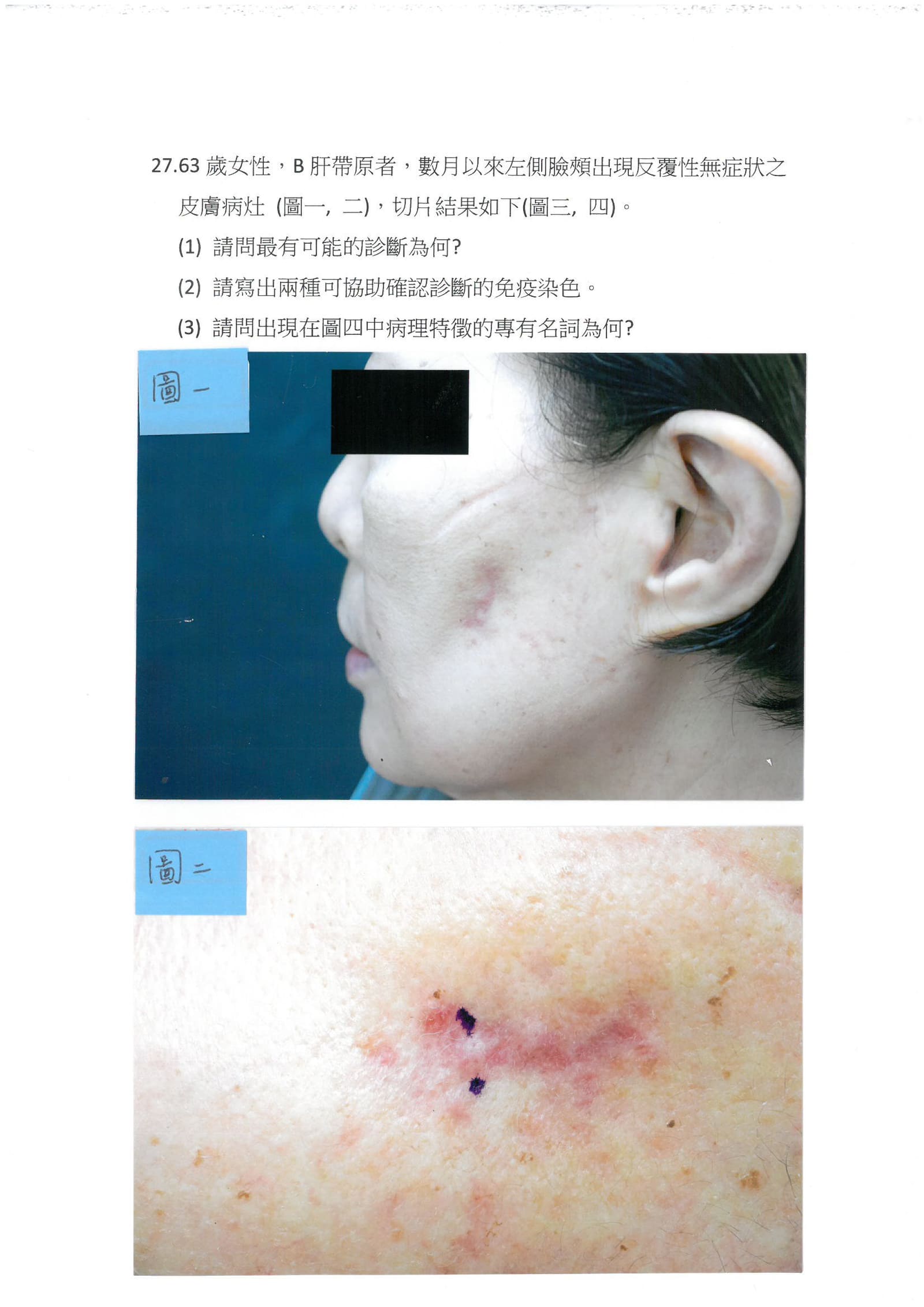 第27題 (p.34)