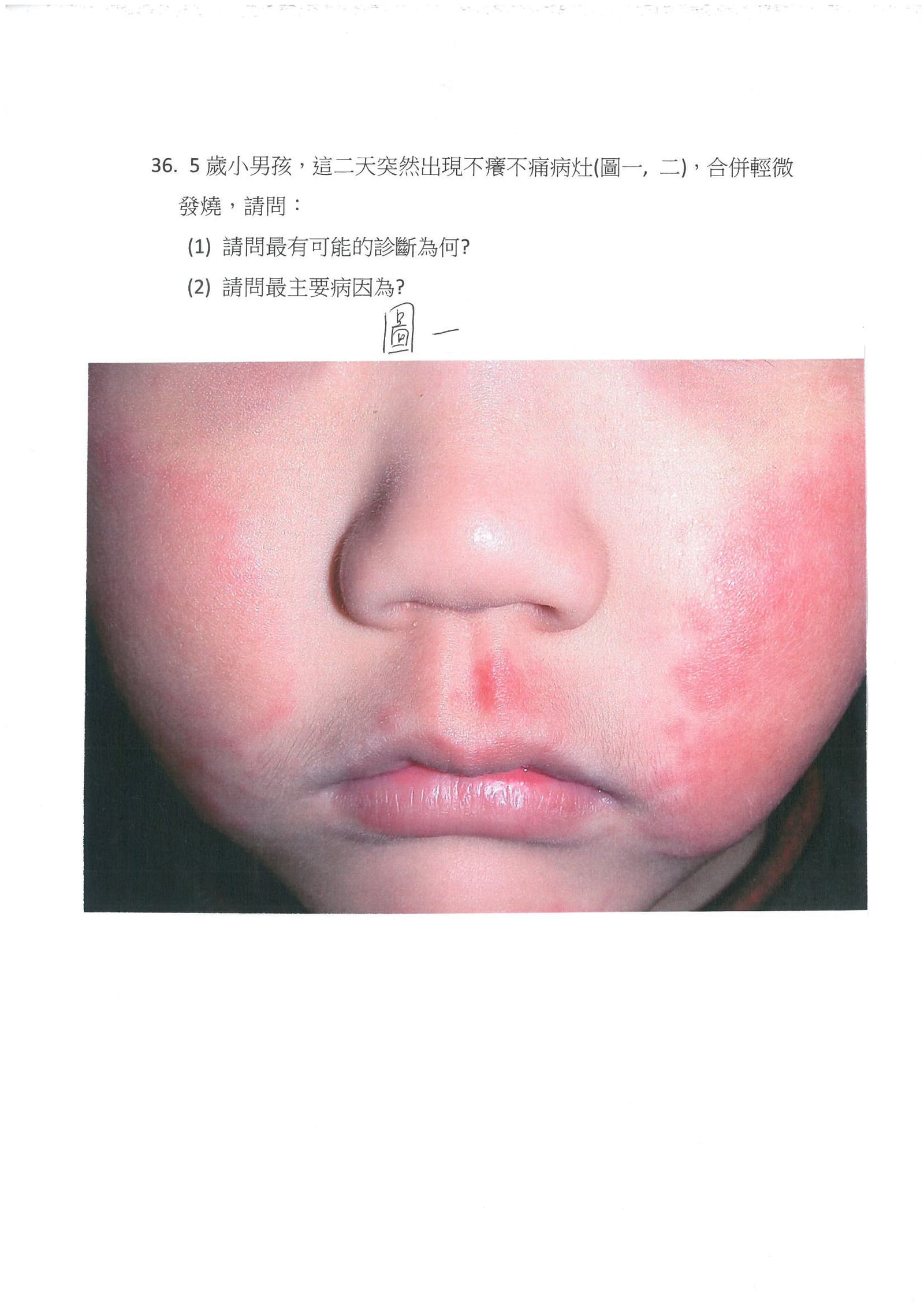 第36題 (p.47)