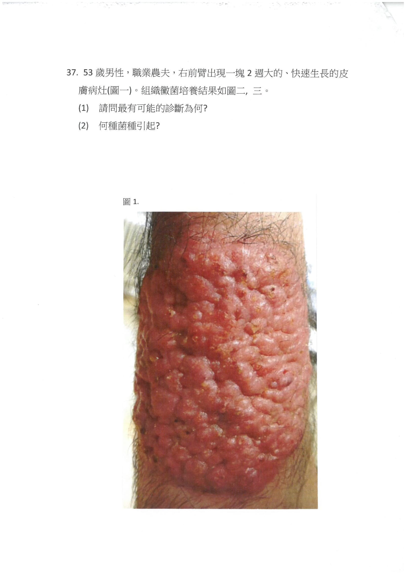 第37題 (p.49)