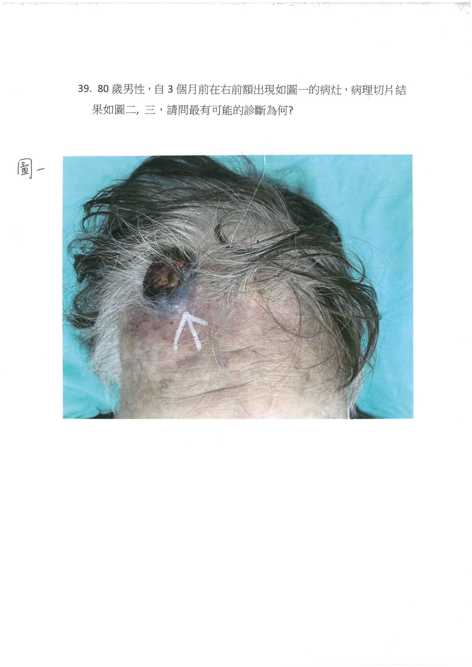 第39題 (p.52)