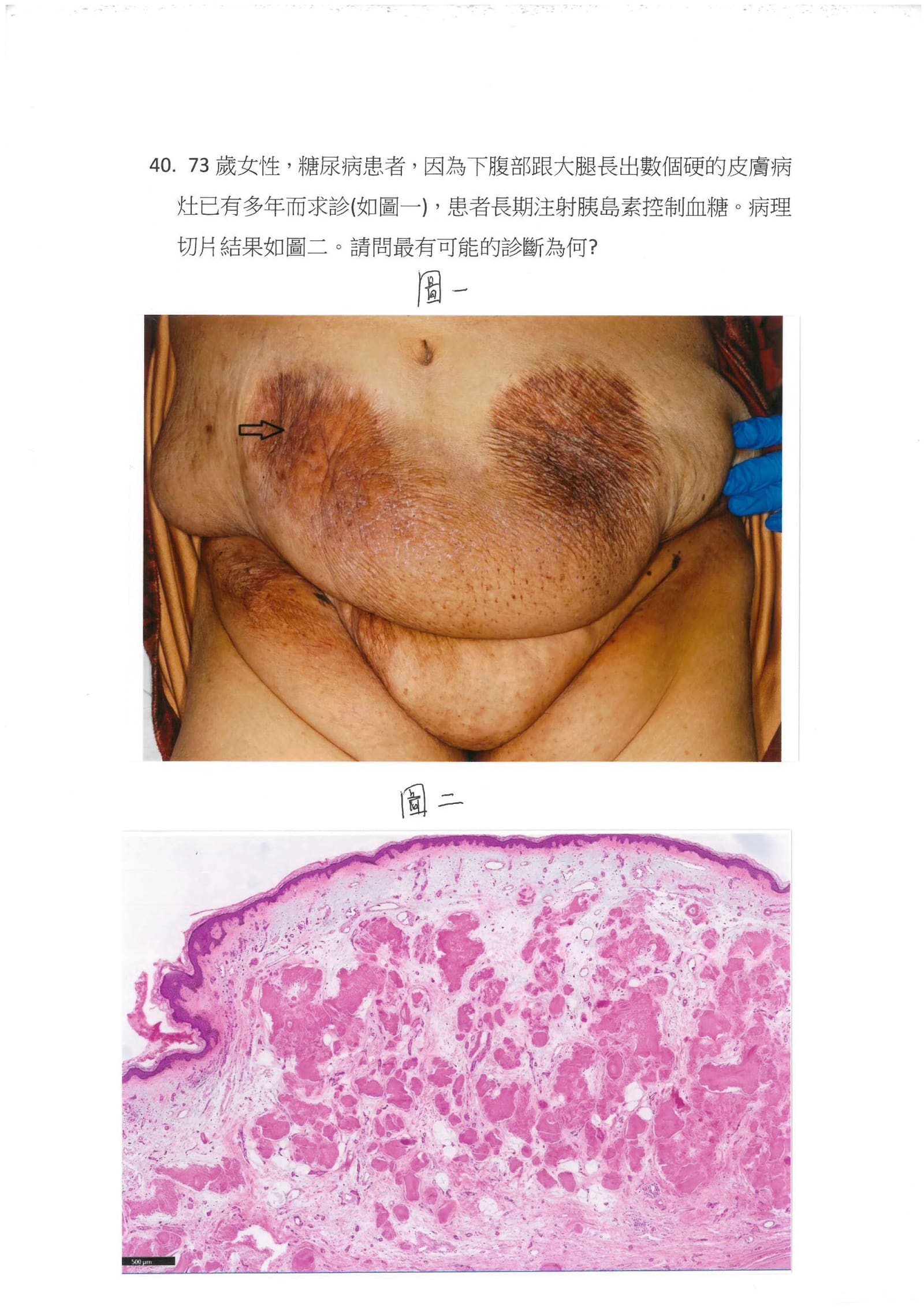 第40題 (p.54)